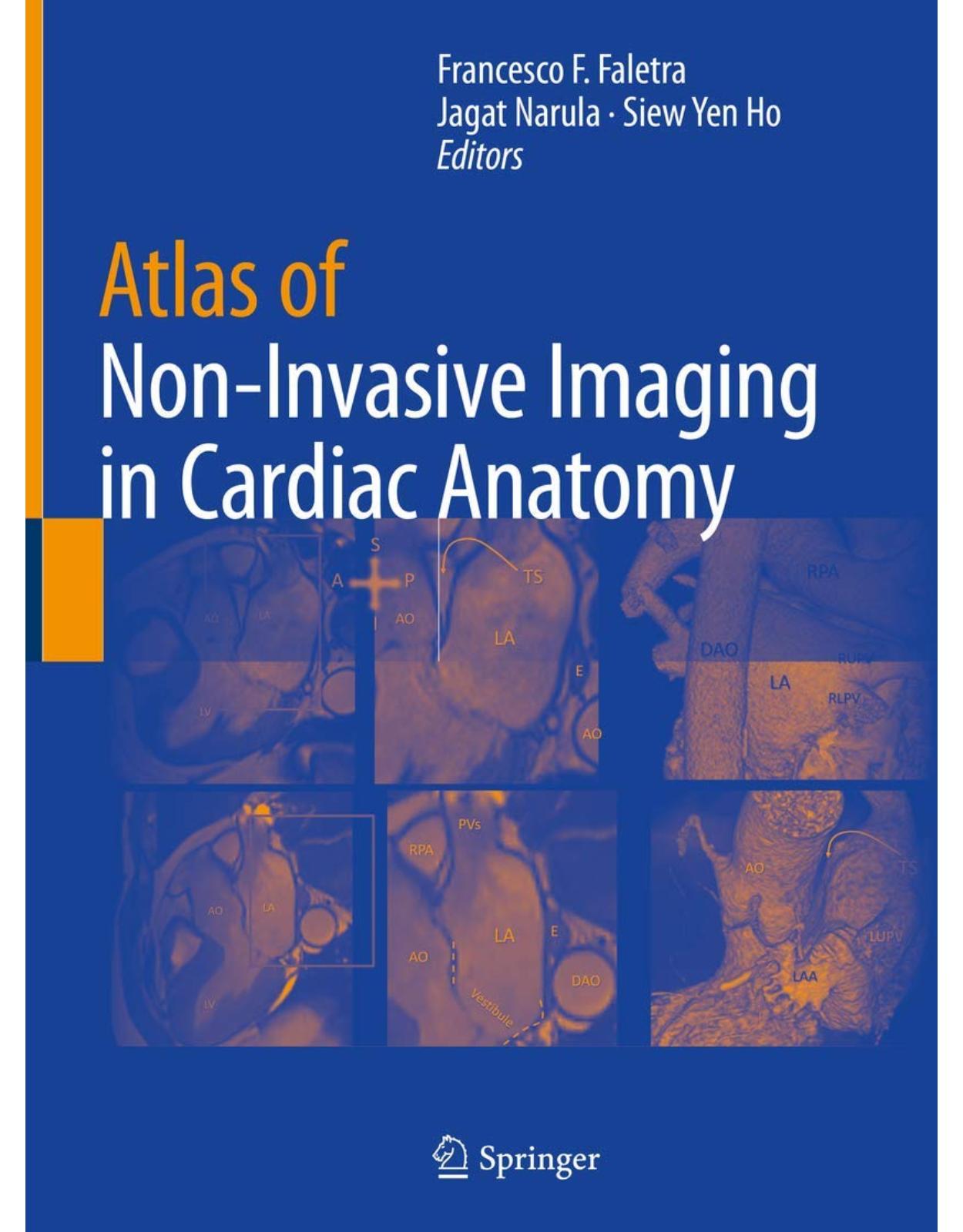 Atlas of Non-Invasive Imaging in Cardiac Anatomy