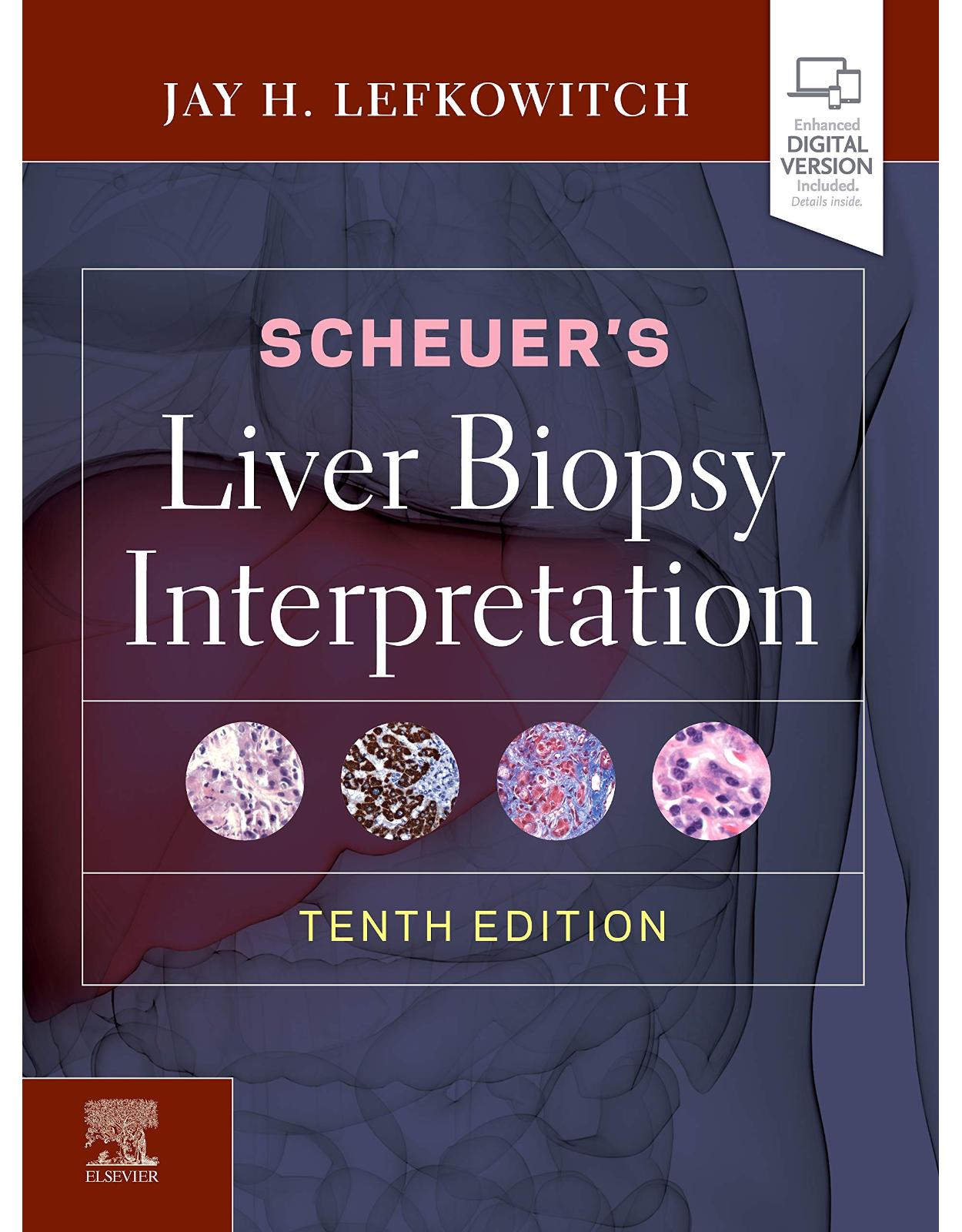 Scheuer’s Liver Biopsy Interpretation