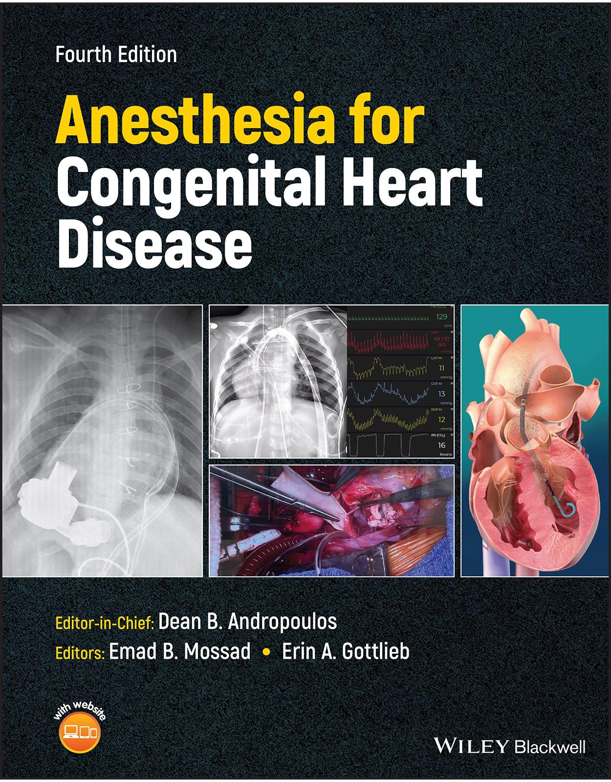 Anesthesia for Congenital Heart Disease