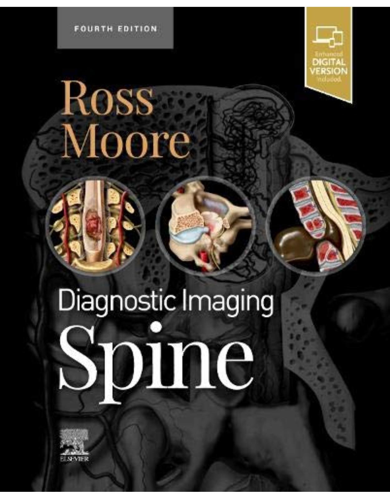 Diagnostic Imaging: Spine 