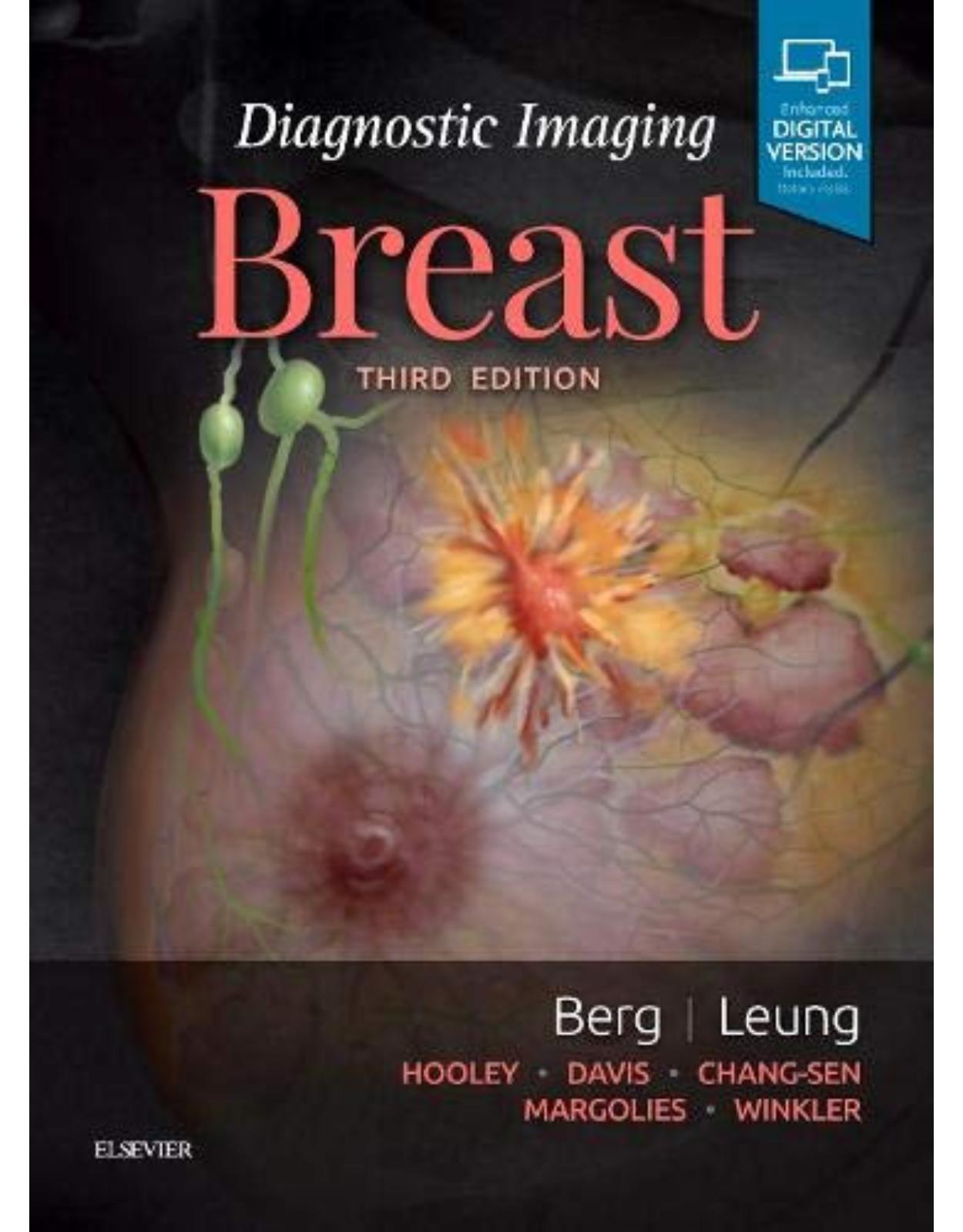 Diagnostic Imaging: Breast 