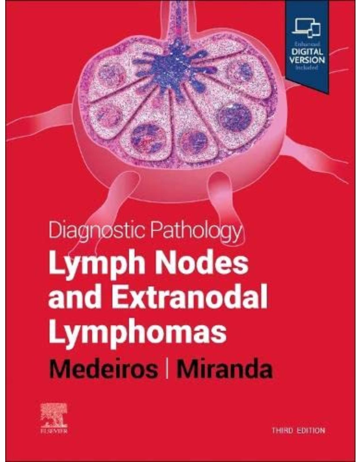 Diagnostic Pathology: Lymph Nodes and Extranodal Lymphomas 