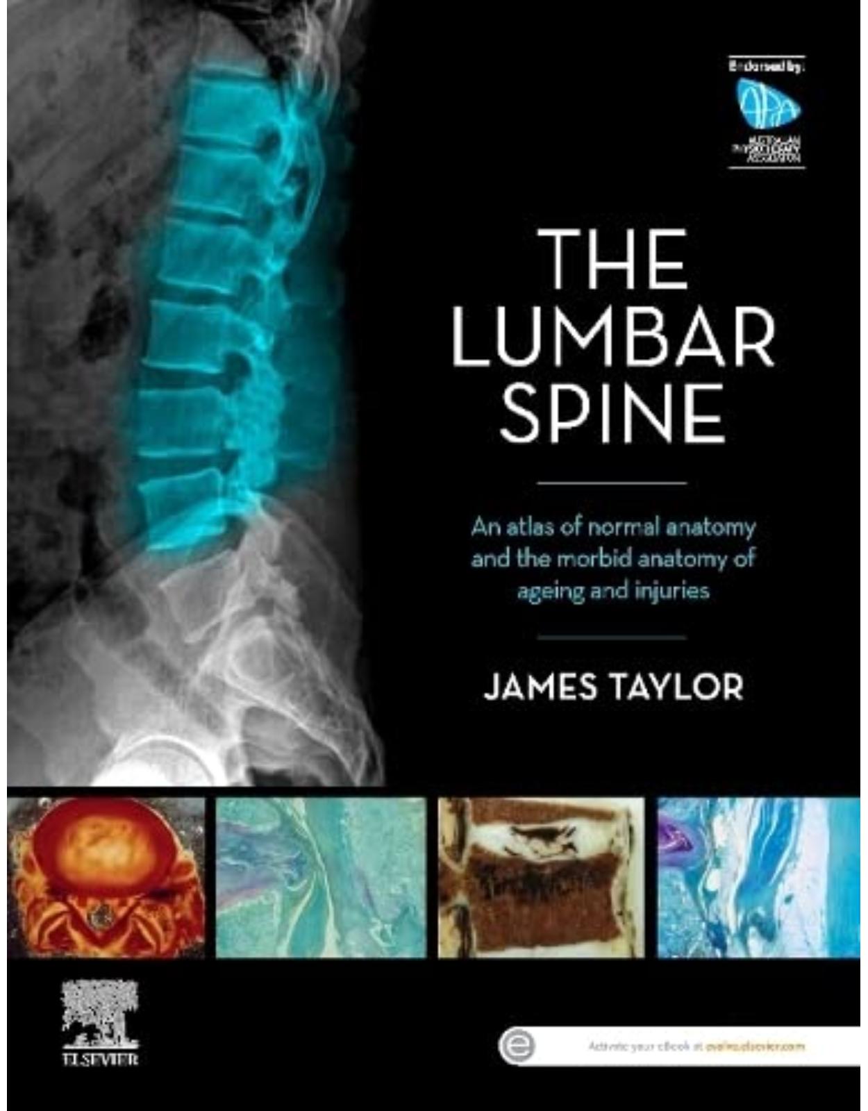 The Lumbar Spine