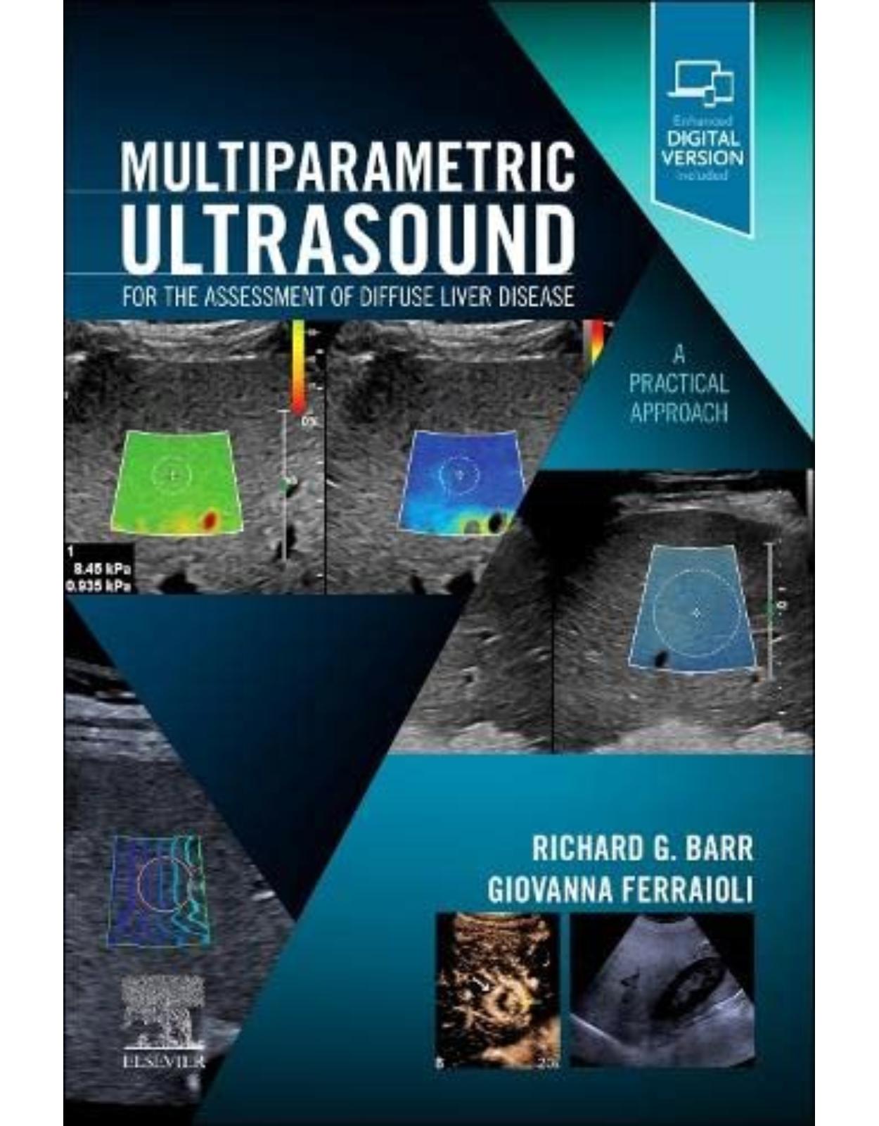 Multiparametric Ultrasound for the Assessment of Diffuse Liver Disease