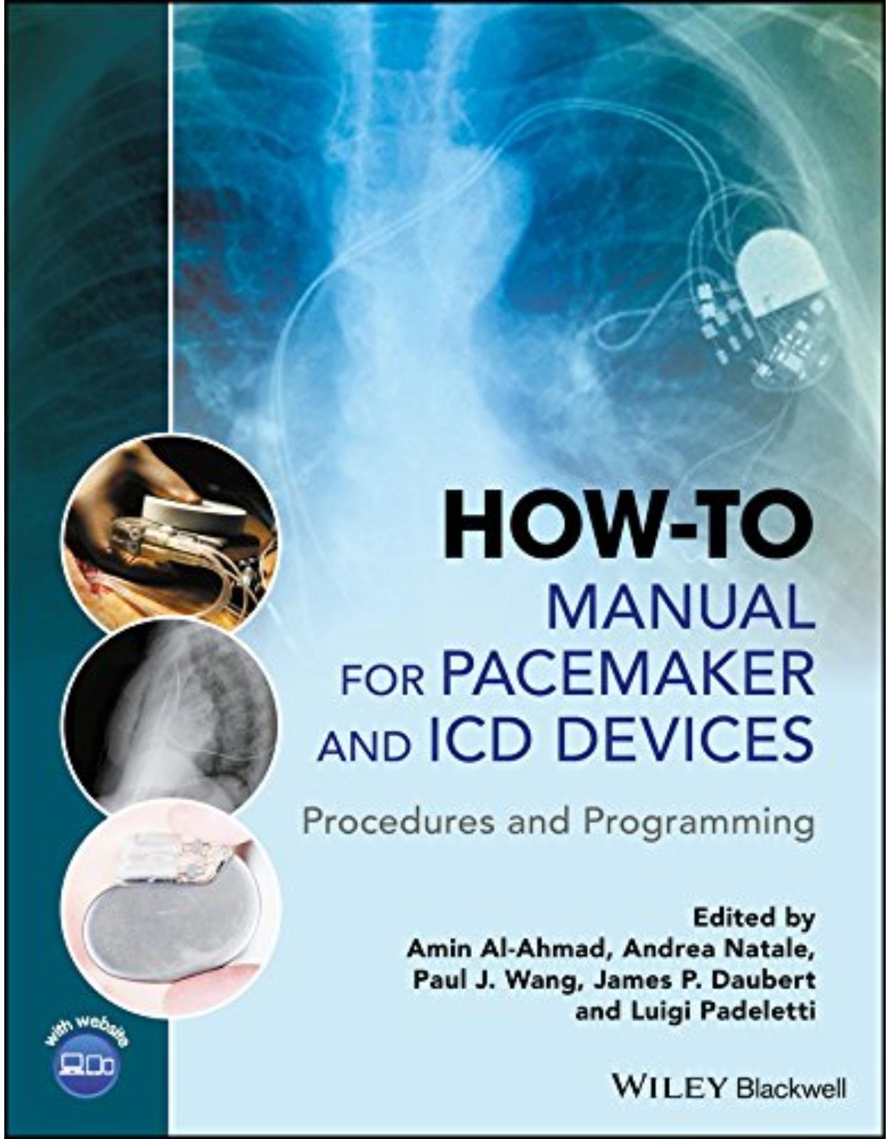 How-to Manual for Pacemaker and ICD Devices: Procedures and Programming