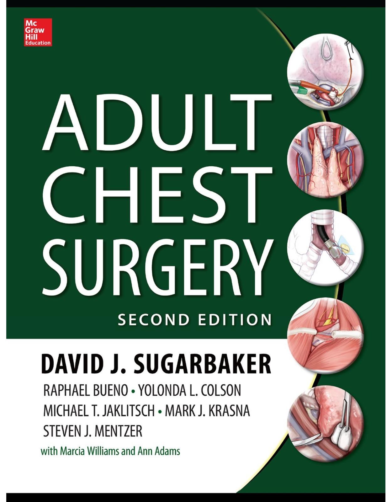 Adult Chest Surgery, 2nd edition
