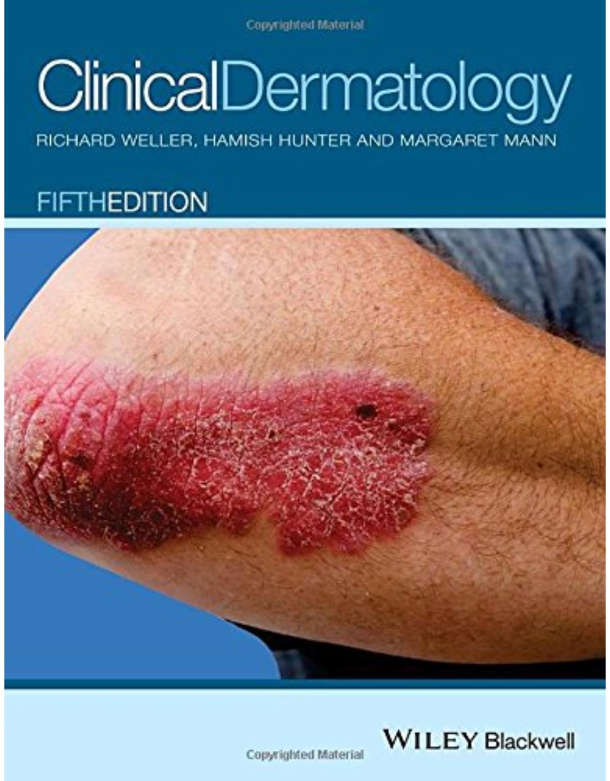 Clinical Dermatology