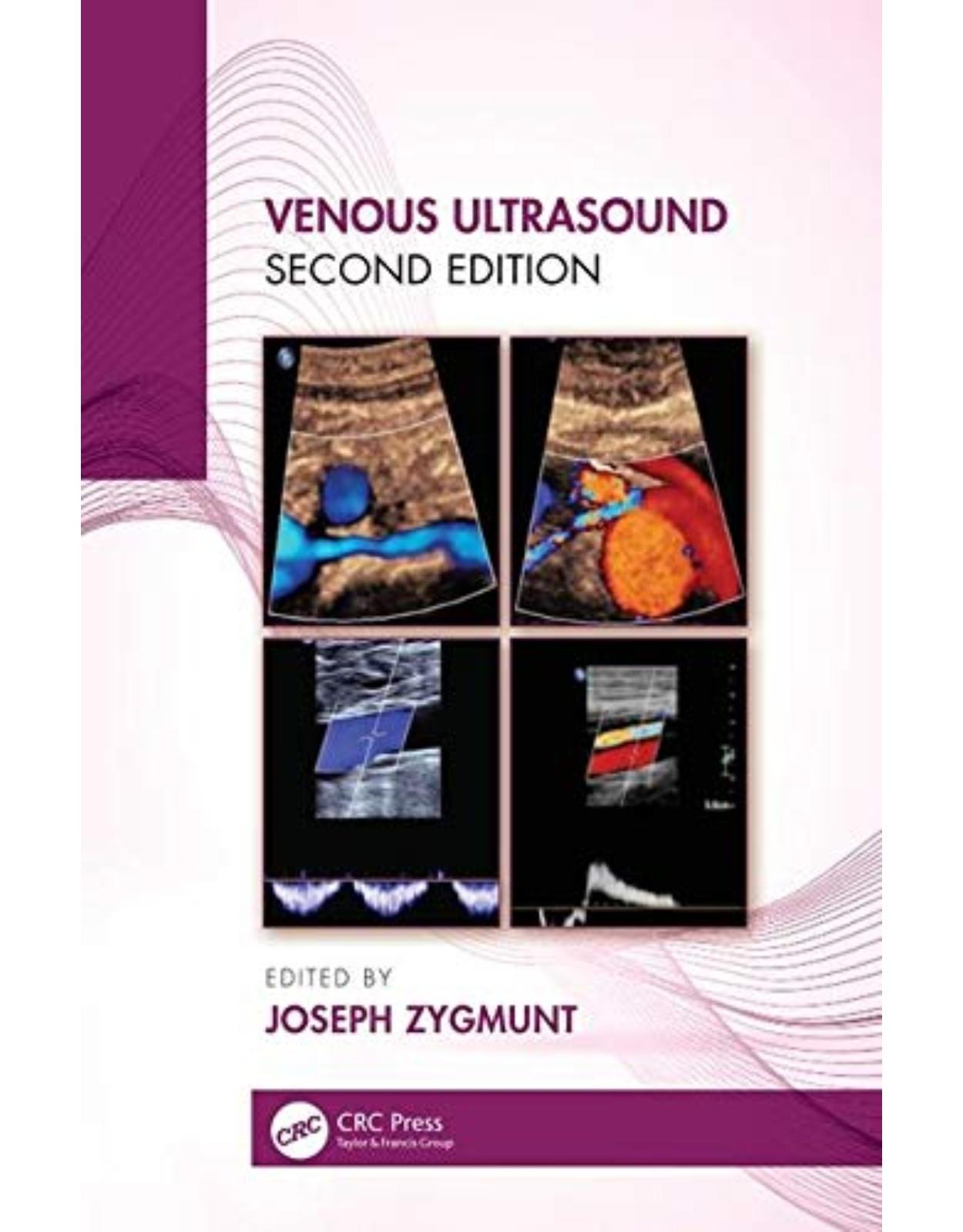 Venous Ultrasound