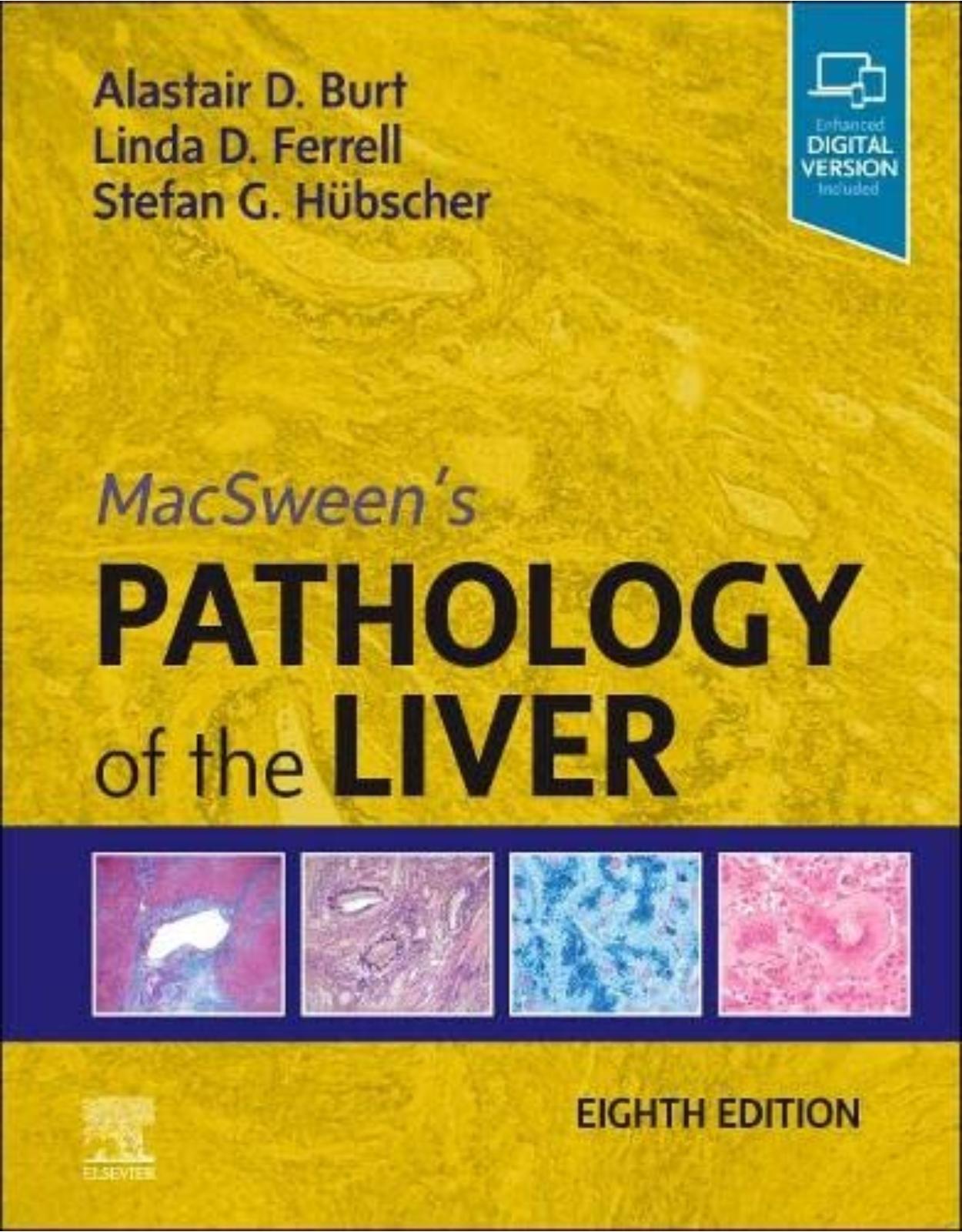 MacSween’s Pathology of the Liver 