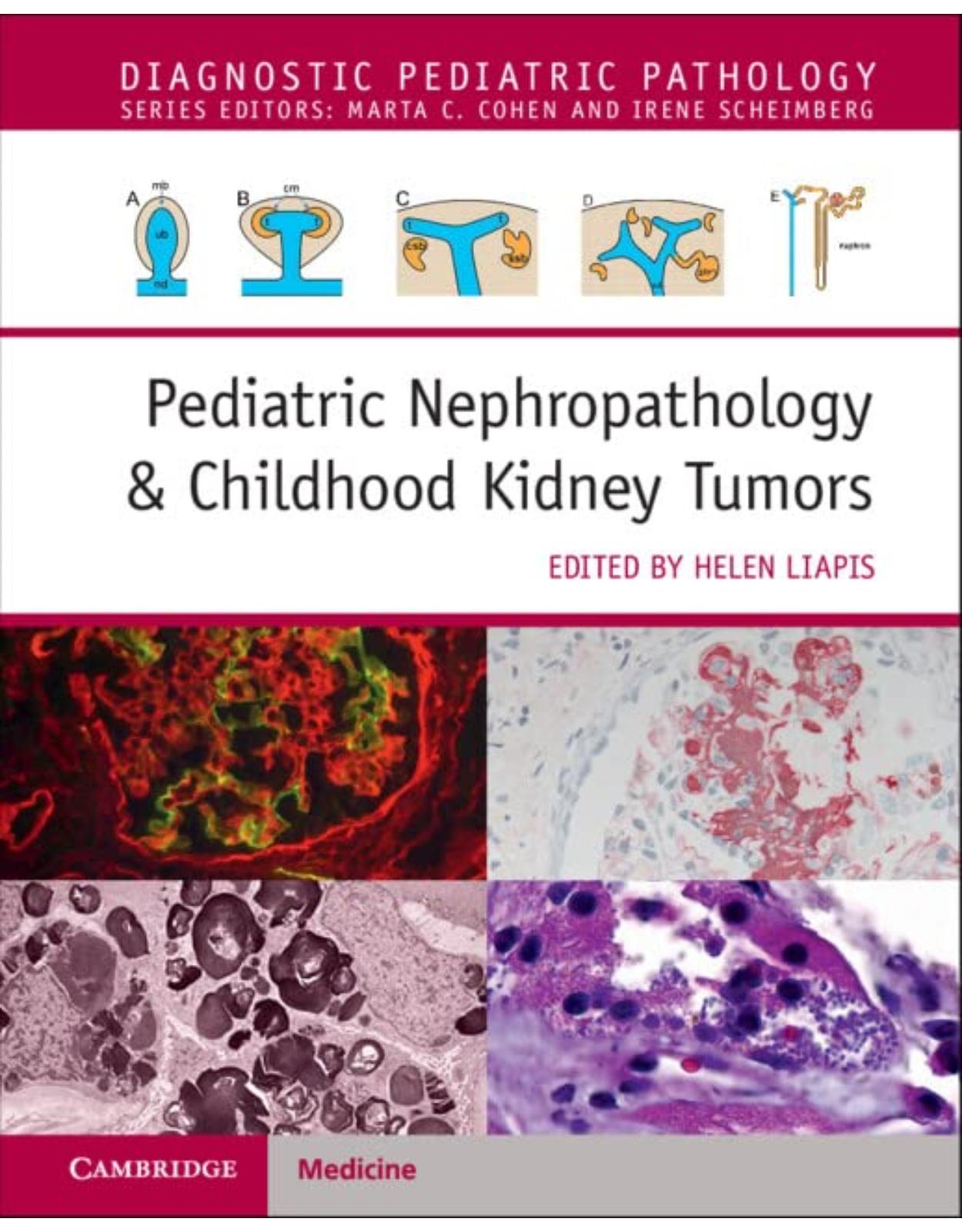 Pediatric Nephropathology & Childhood Kidney Tumors with Online Resource