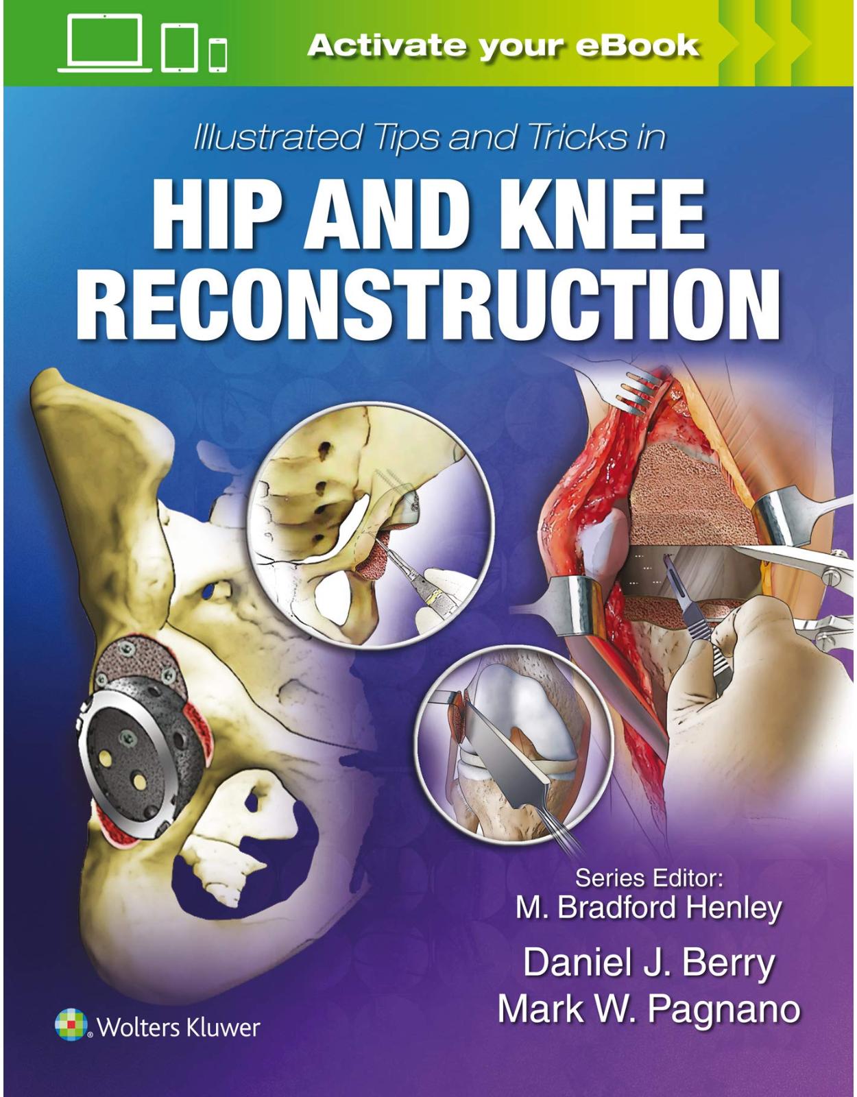 Illustrated Tips and Tricks in Hip and Knee Reconstructive and Replacement Surgery 