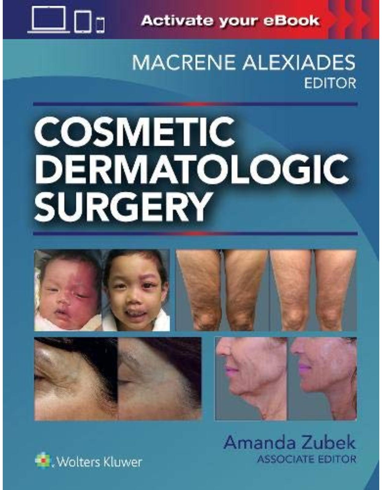 Cosmetic Dermatologic Surgery 