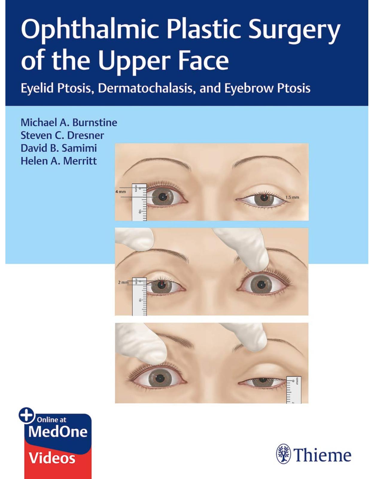 Ophthalmic Plastic Surgery of the Upper Face