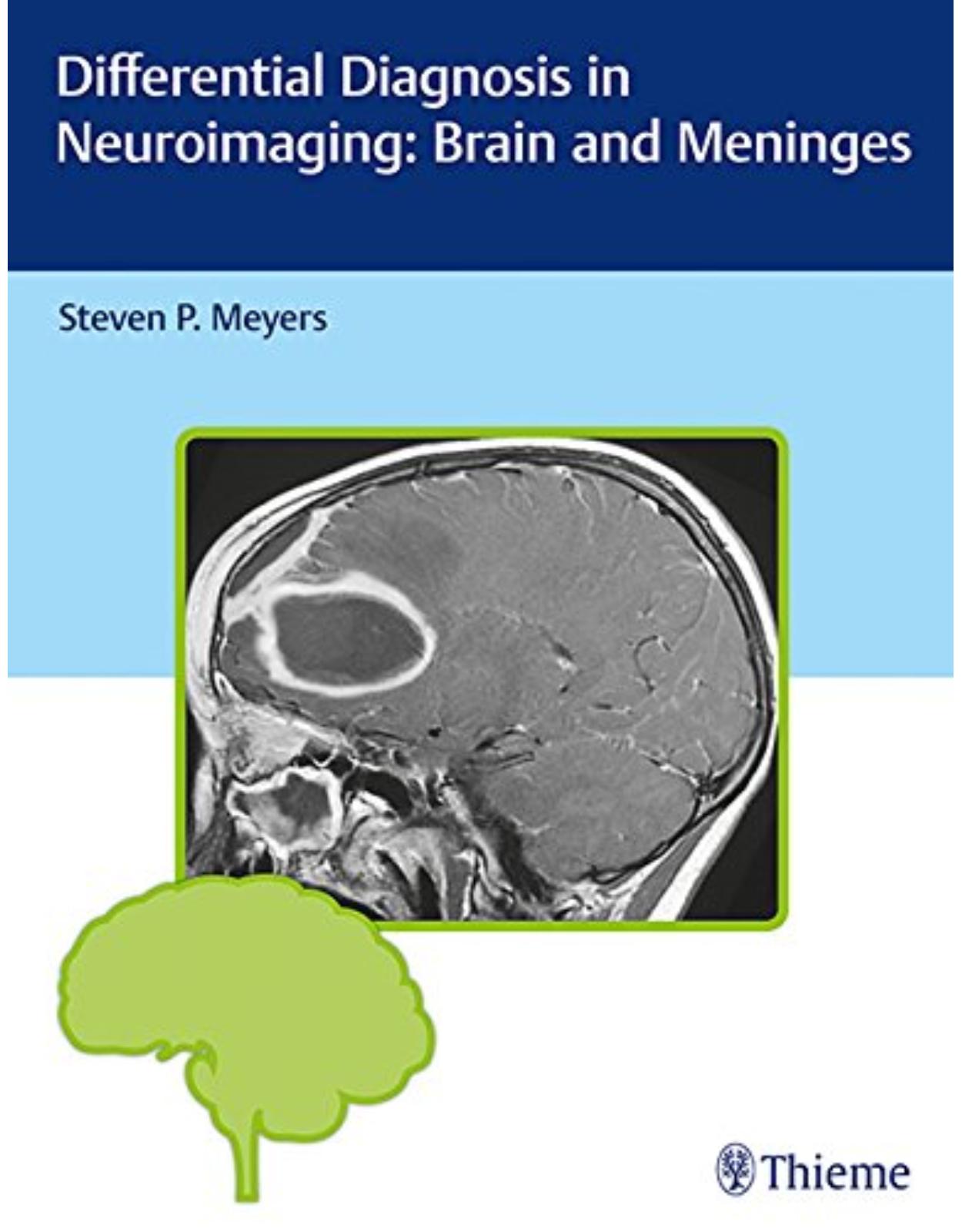 Differential Diagnosis in Neuroimaging: Brain and Meninges