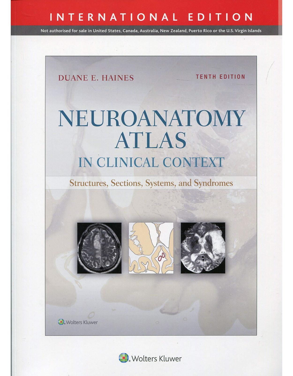 Neuroanatomy Atlas in Clinical Context: Structures, Sections, Systems, and Syndromes( TENTH EDITION)