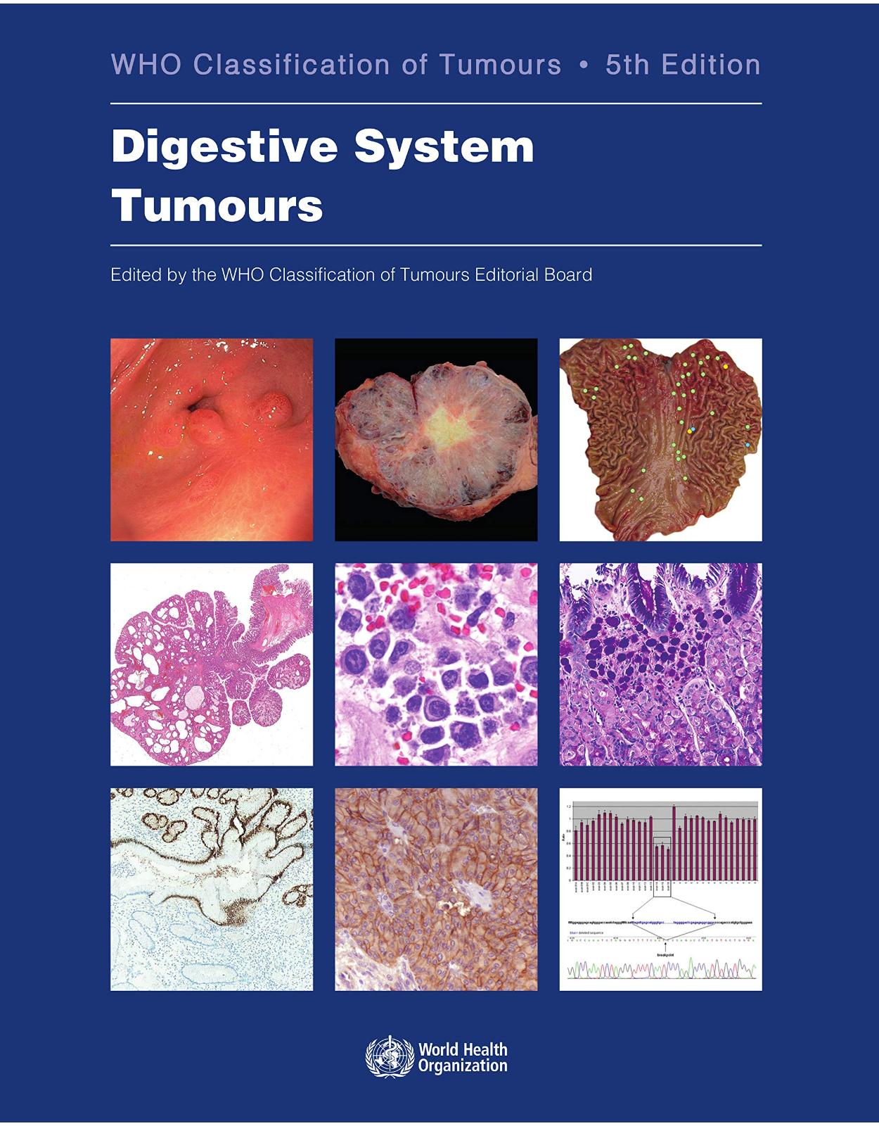 Digestive System Tumours (Who Classification of Tumours) 