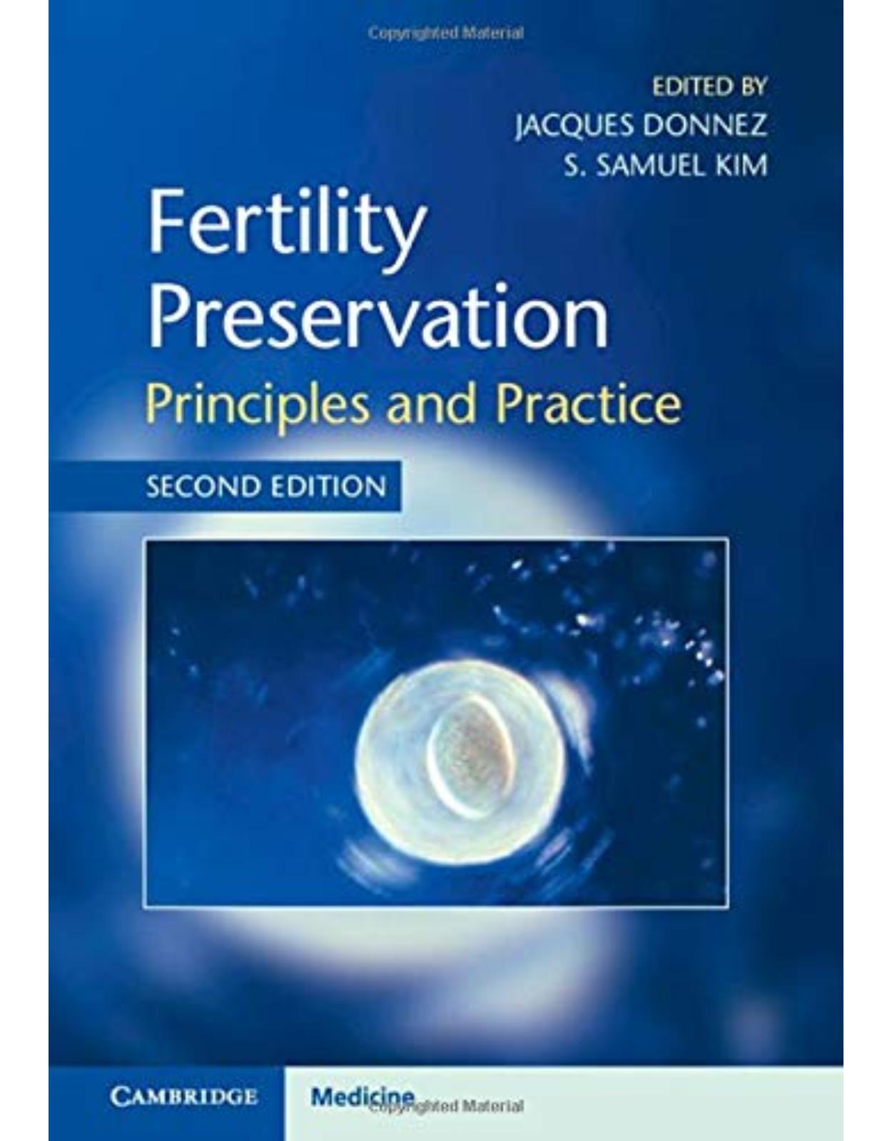 Fertility Preservation: Principles and Practice