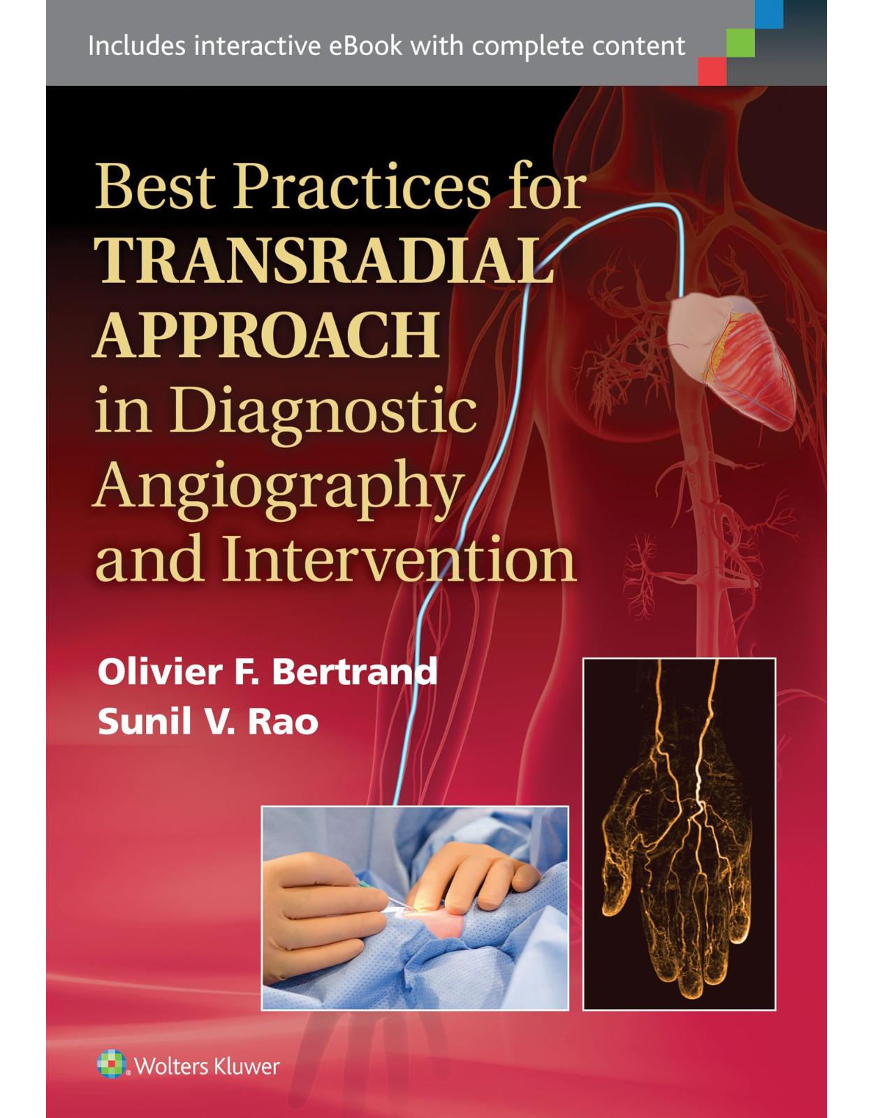 Best Practices for Transradial Approach in Diagnostic Angiography and Intervention