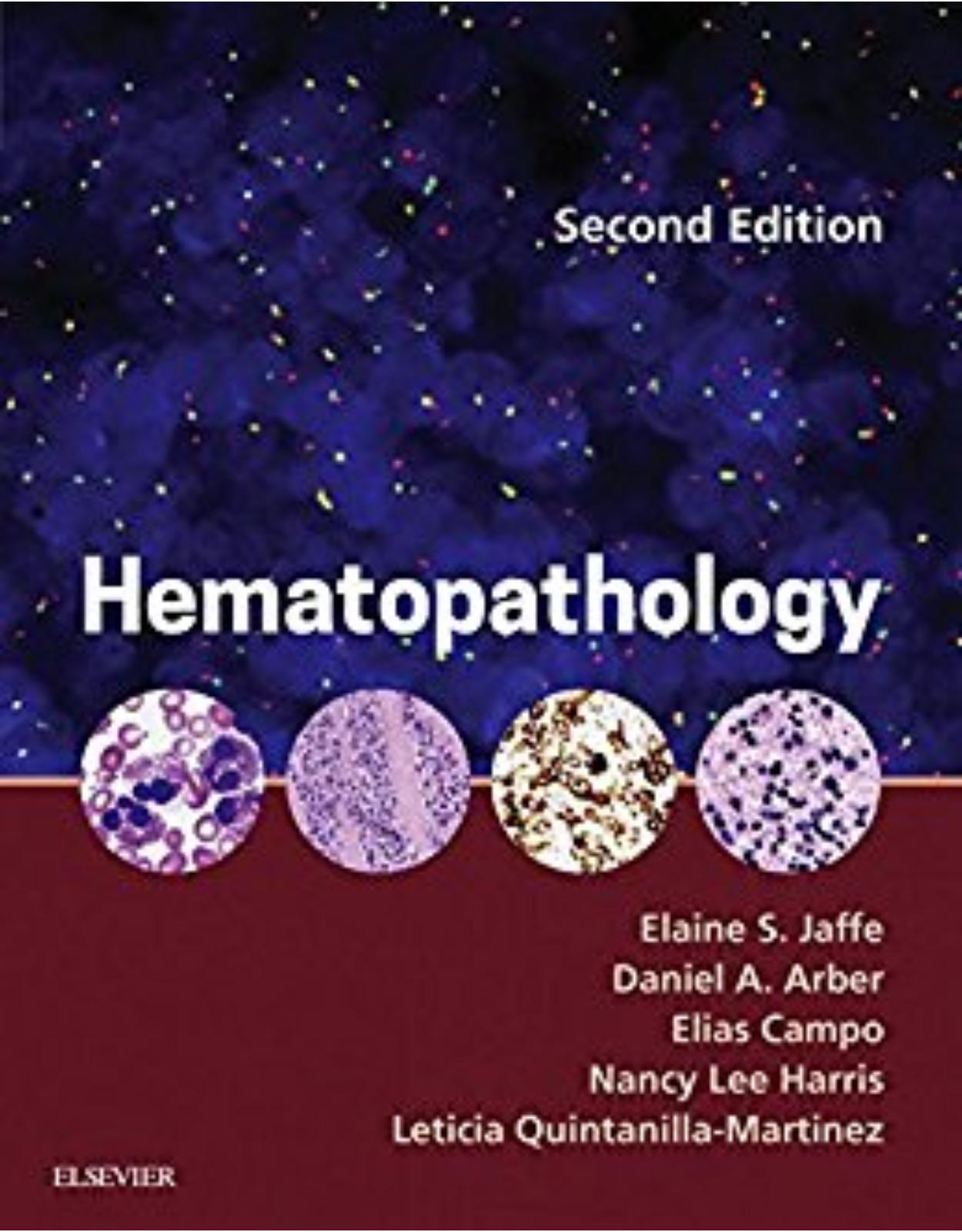 Hematopathology, 2nd Edition