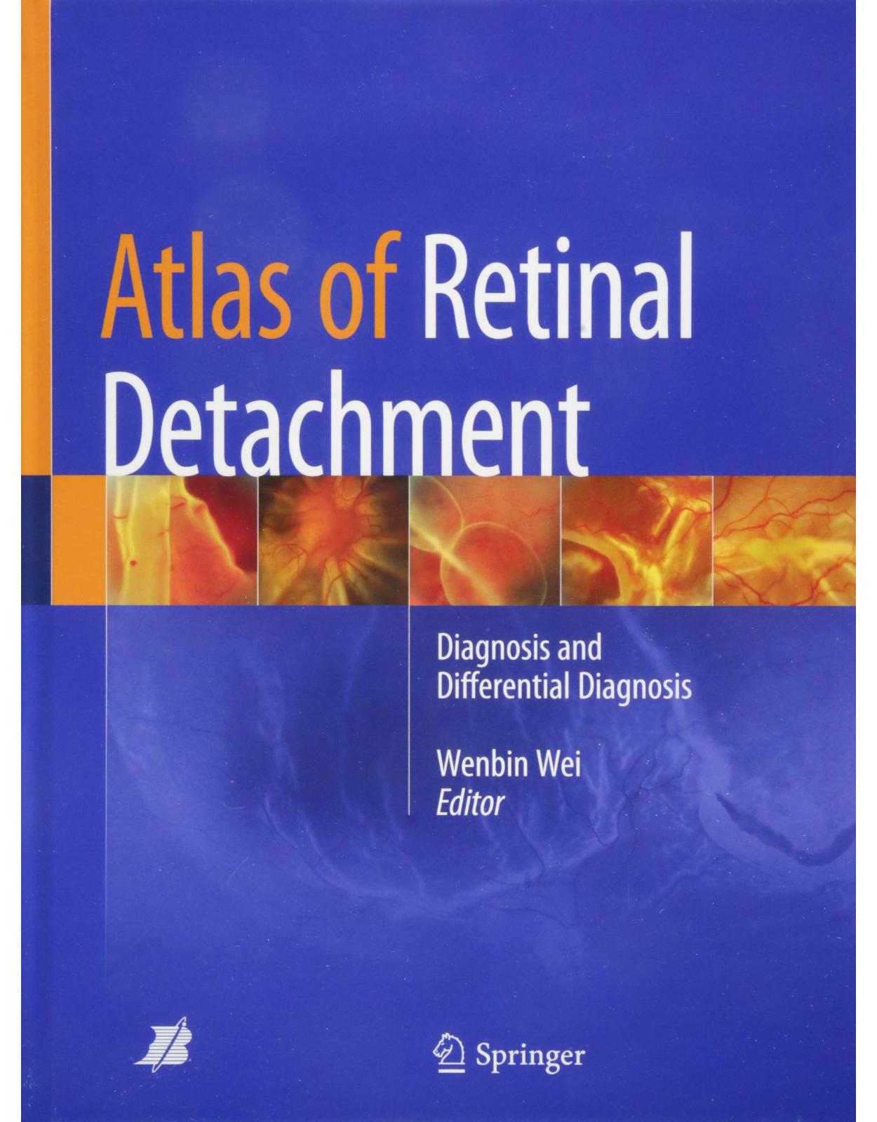Atlas of Retinal Detachment: Diagnosis and Differential Diagnosis