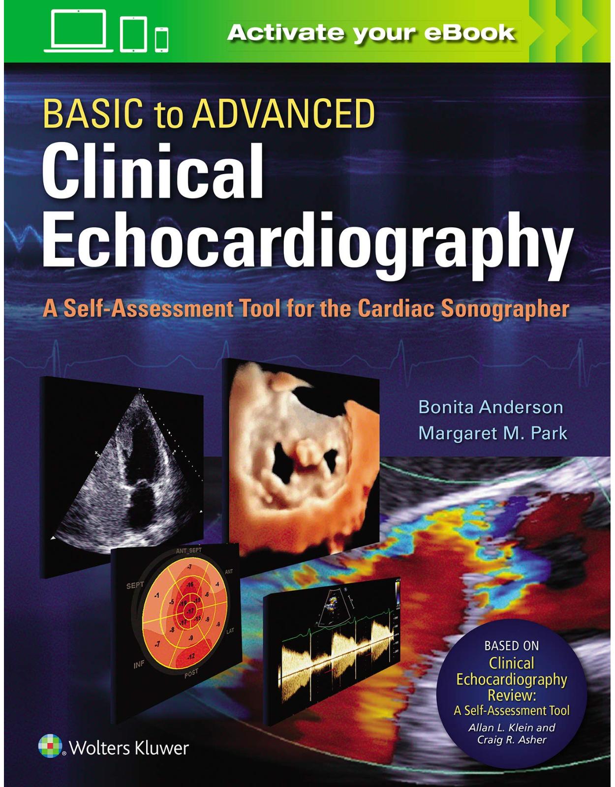 Basic to Advanced Clinical Echocardiography