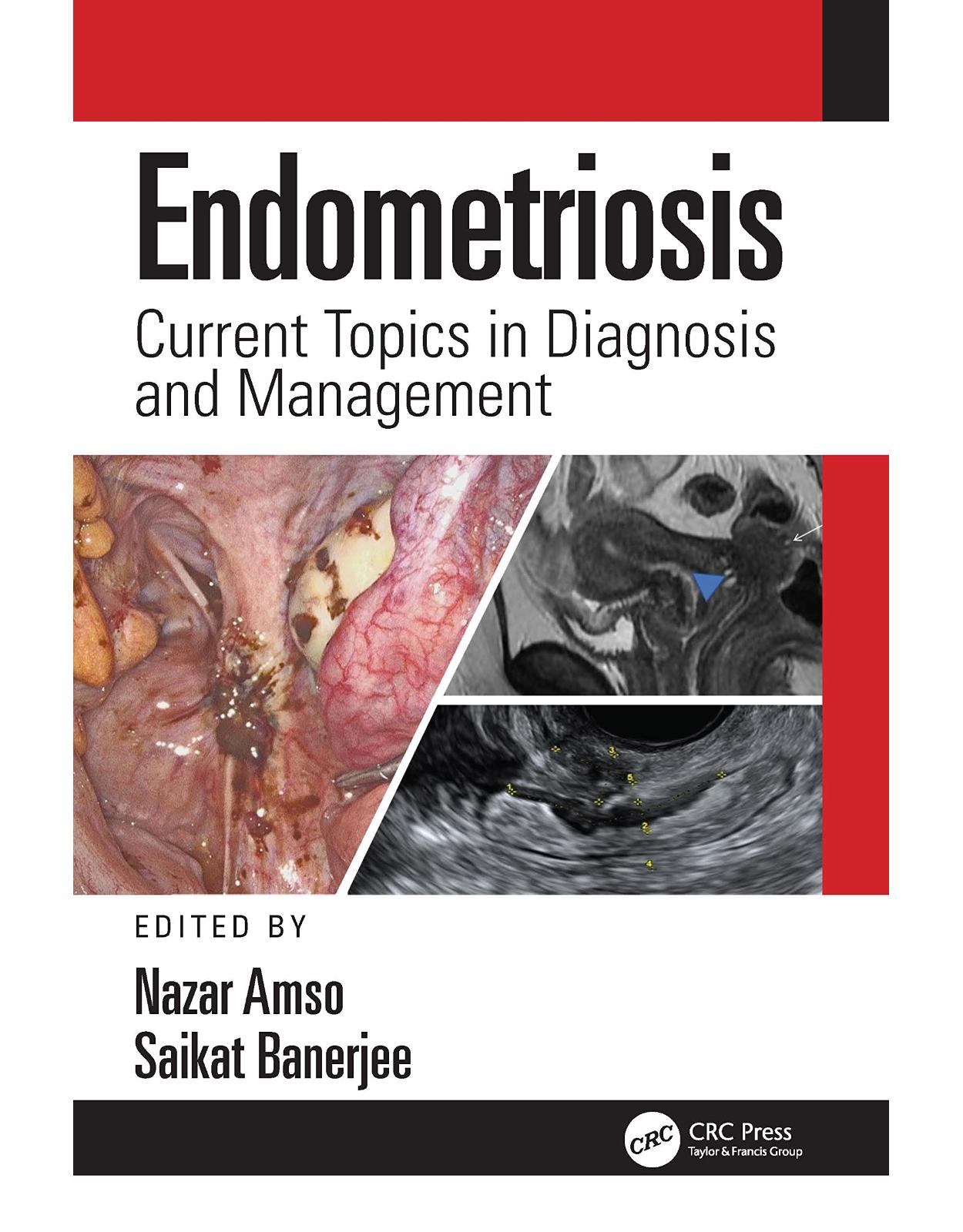 Endometriosis: Current Topics in Diagnosis and Management