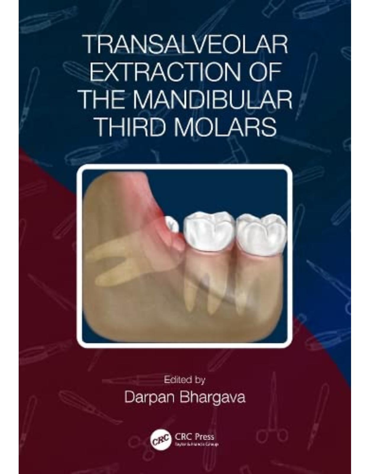 Transalveolar Extraction of the Mandibular Third Molars