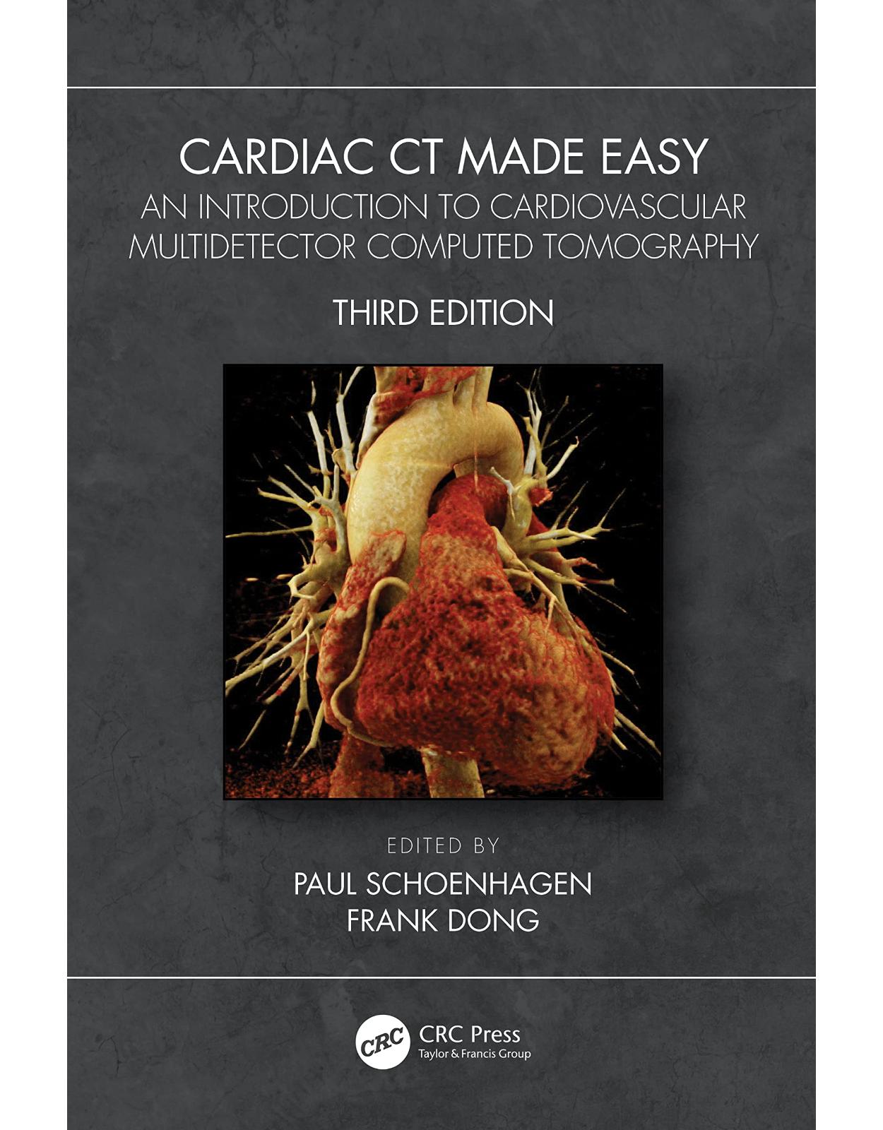 Cardiac CT Made Easy