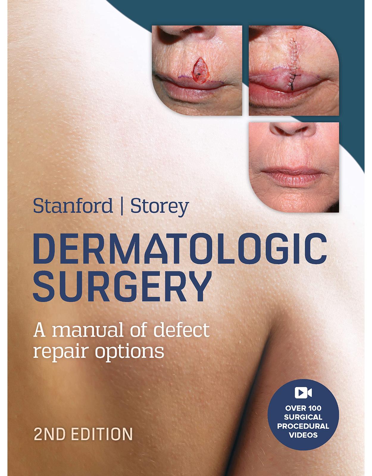 Dermatologic Surgery, 2nd Edition