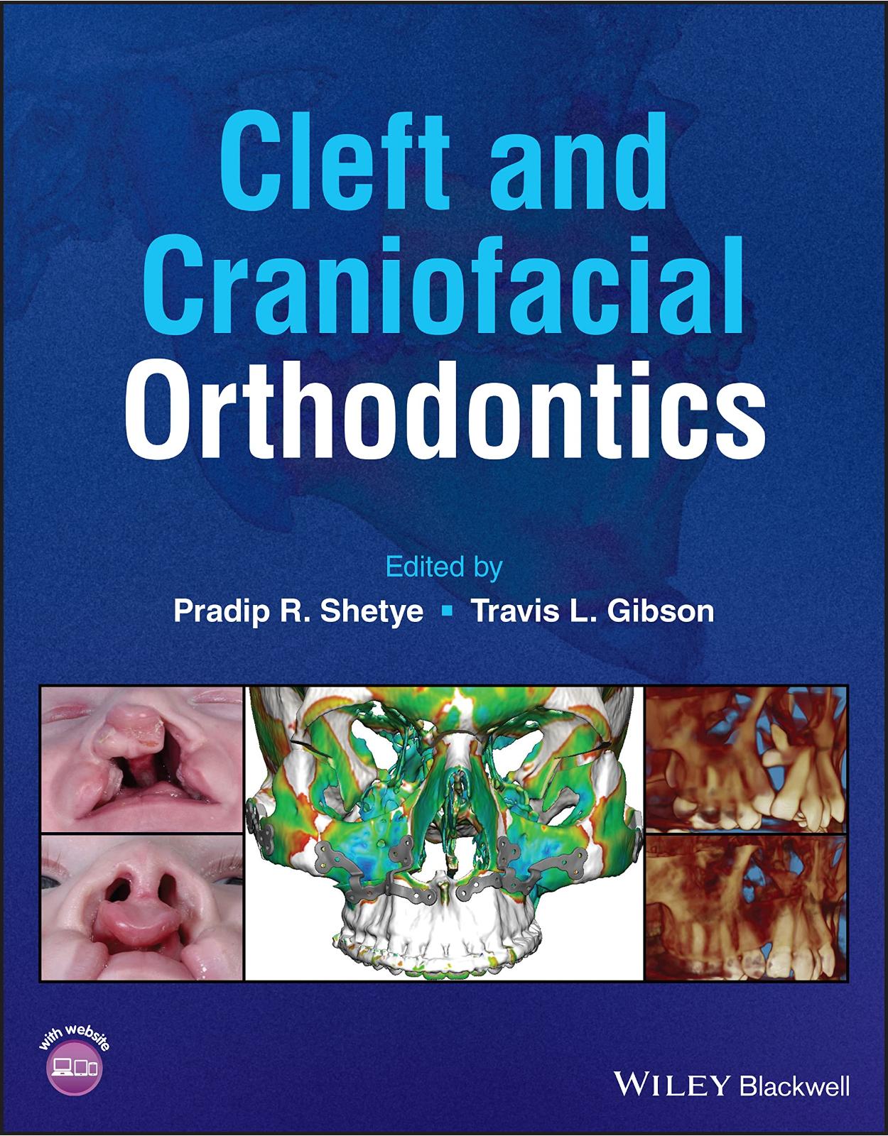 Cleft and Craniofacial Orthodontics 