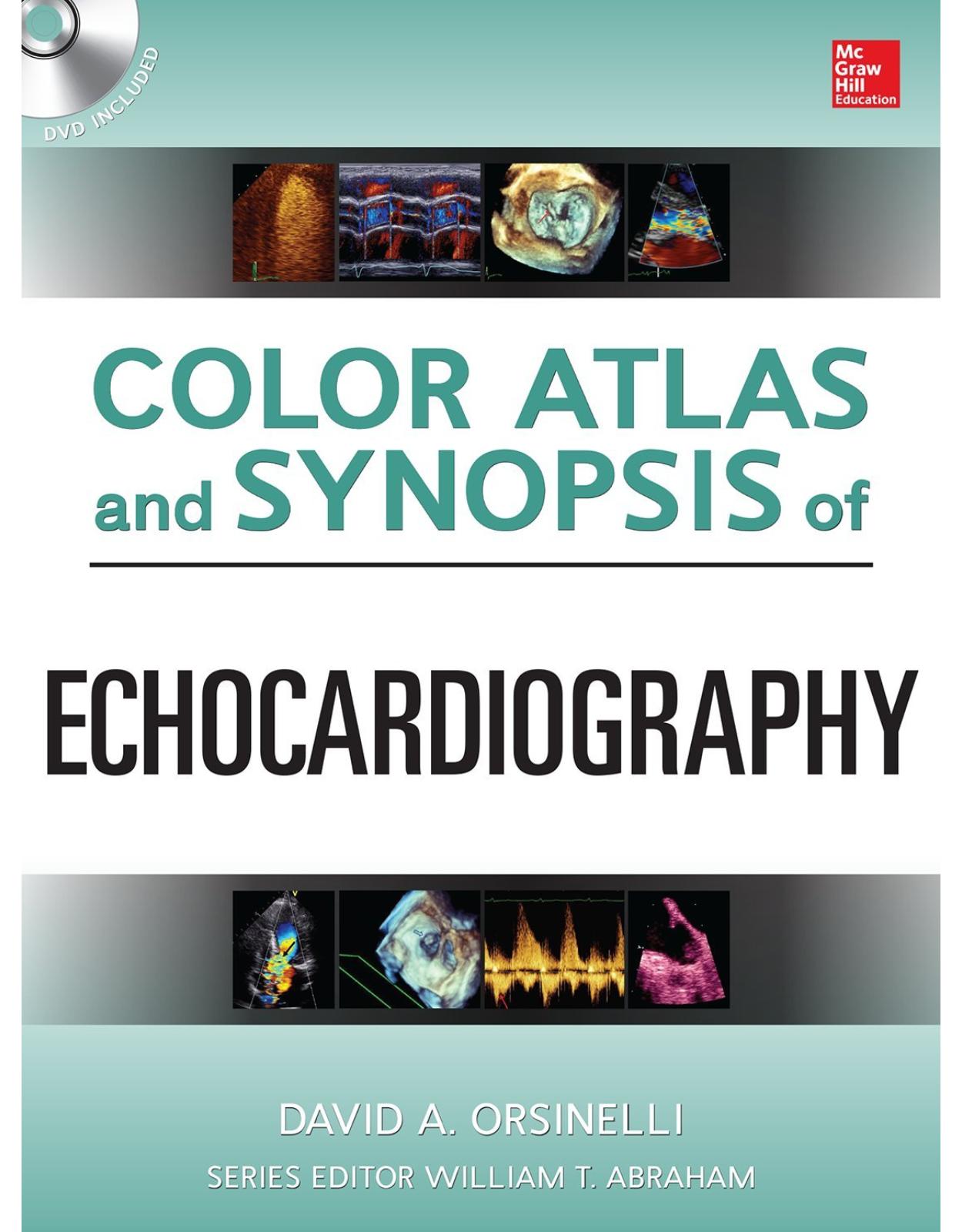 Color Atlas and Synopsis of Echocardiography