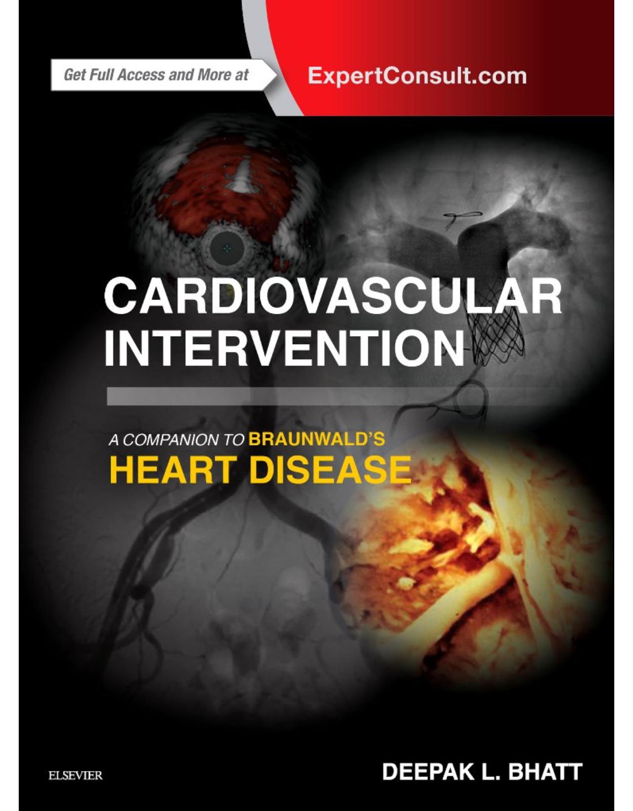 Cardiovascular Intervention: A Companion to Braunwald;s Heart Disease, 1e