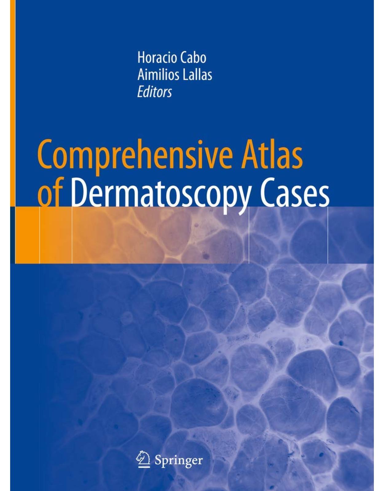 Comprehensive Atlas of Dermatoscopy Cases