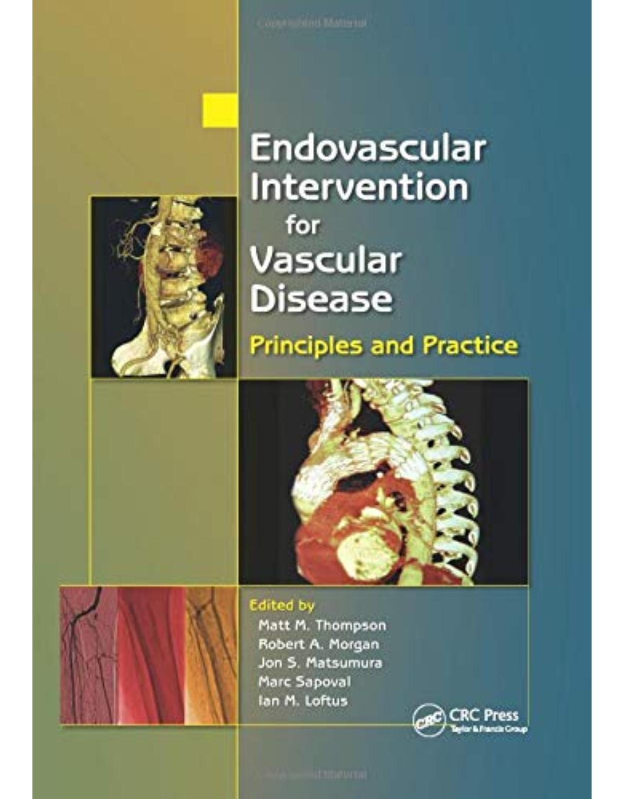 Endovascular Intervention for Vascular Disease