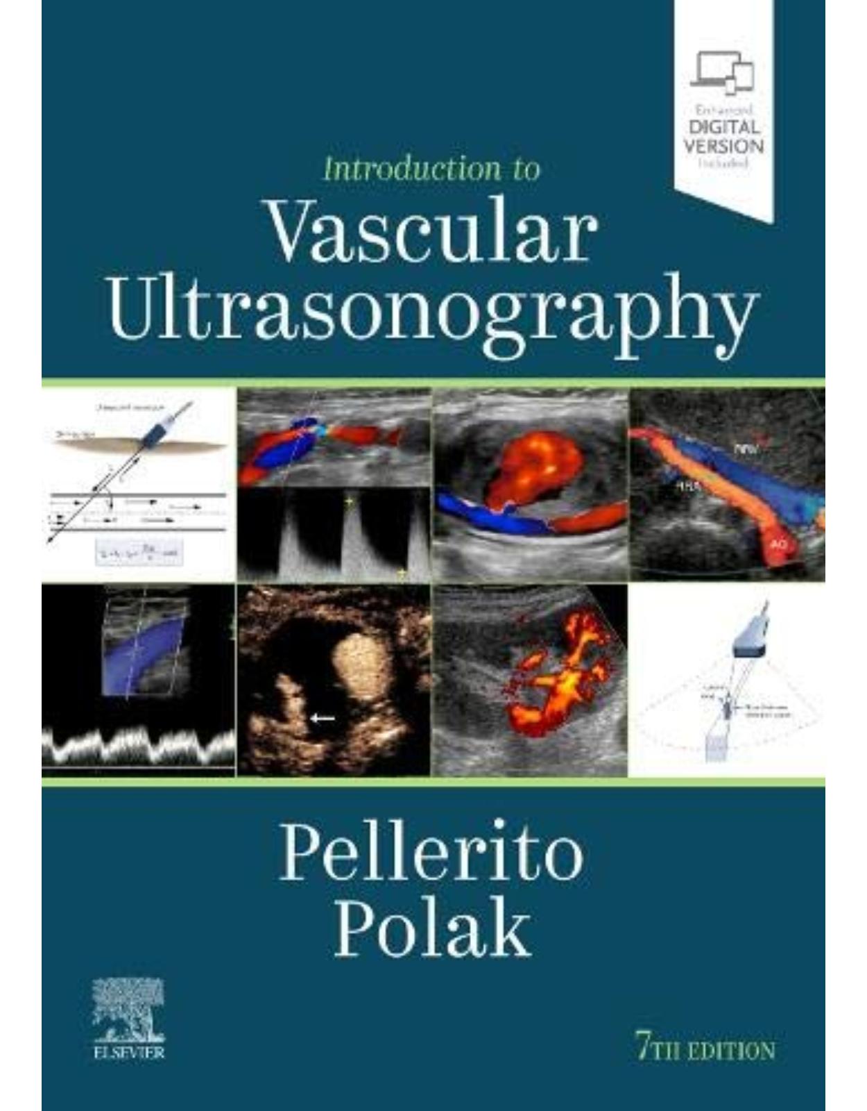 Introduction to Vascular Ultrasonography