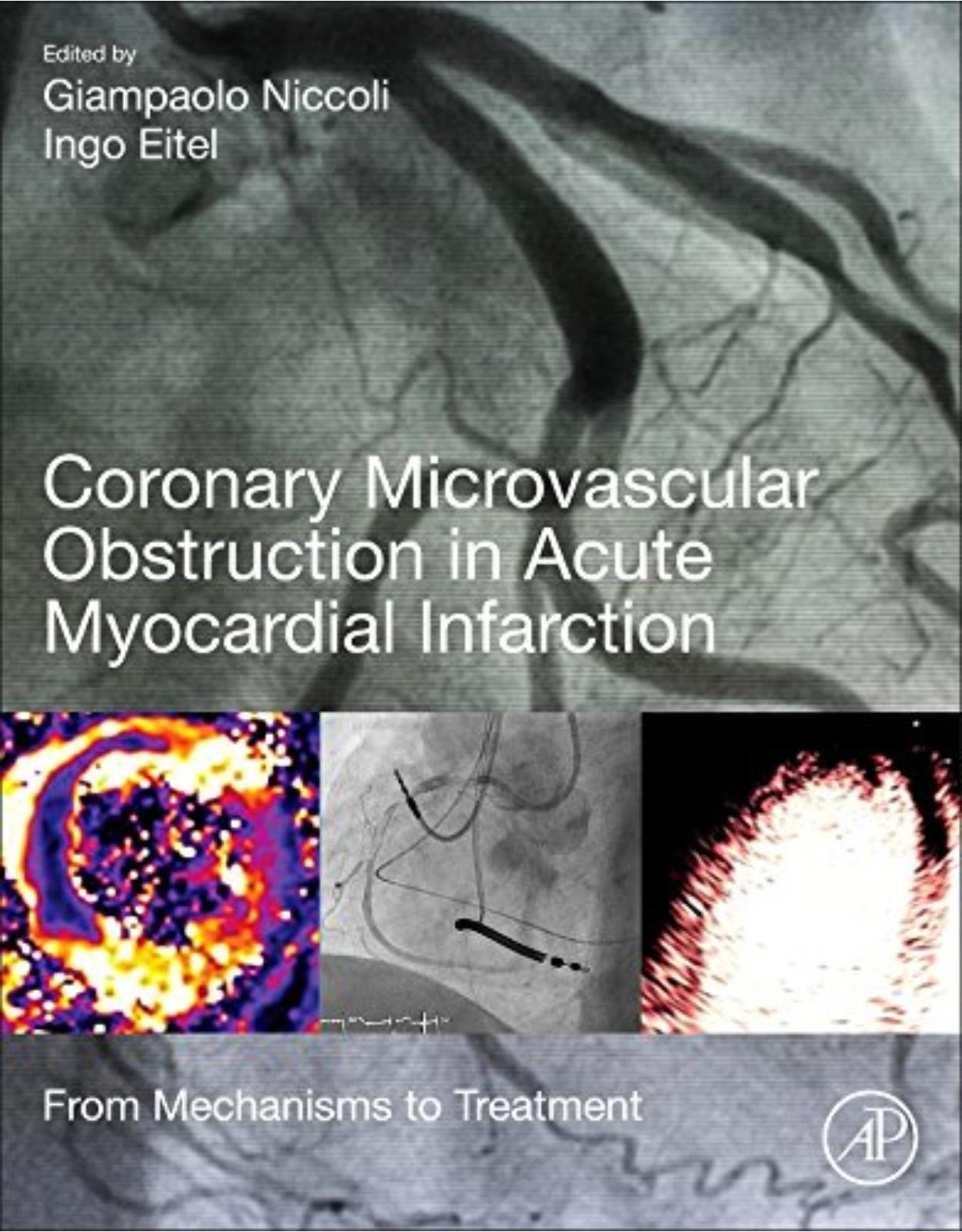 Coronary Microvascular Obstruction in Acute Myocardial Infarction: From Mechanisms to Treatment 