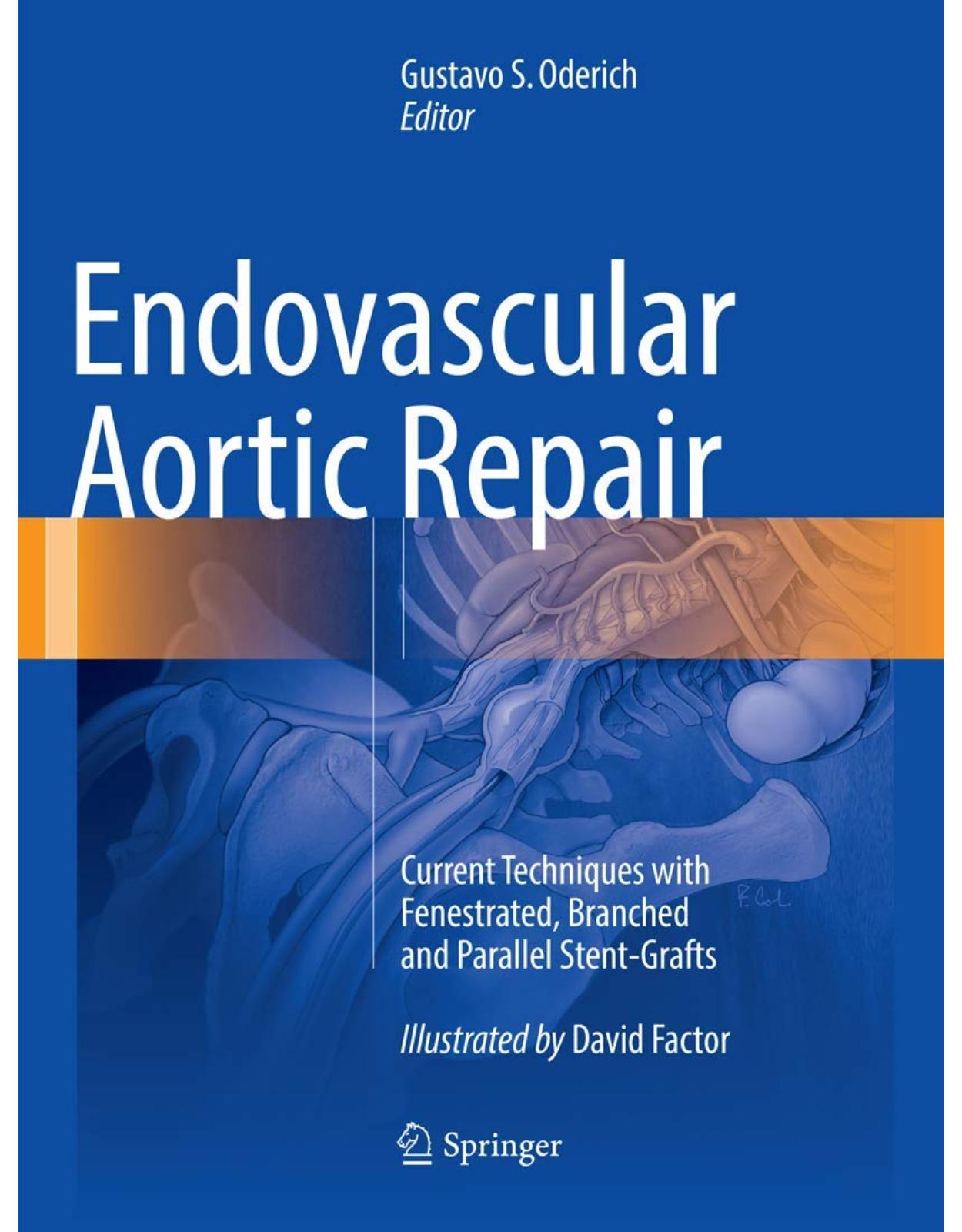 Endovascular Aortic Repair: Current Techniques with Fenestrated, Branched and Parallel Stent-Grafts