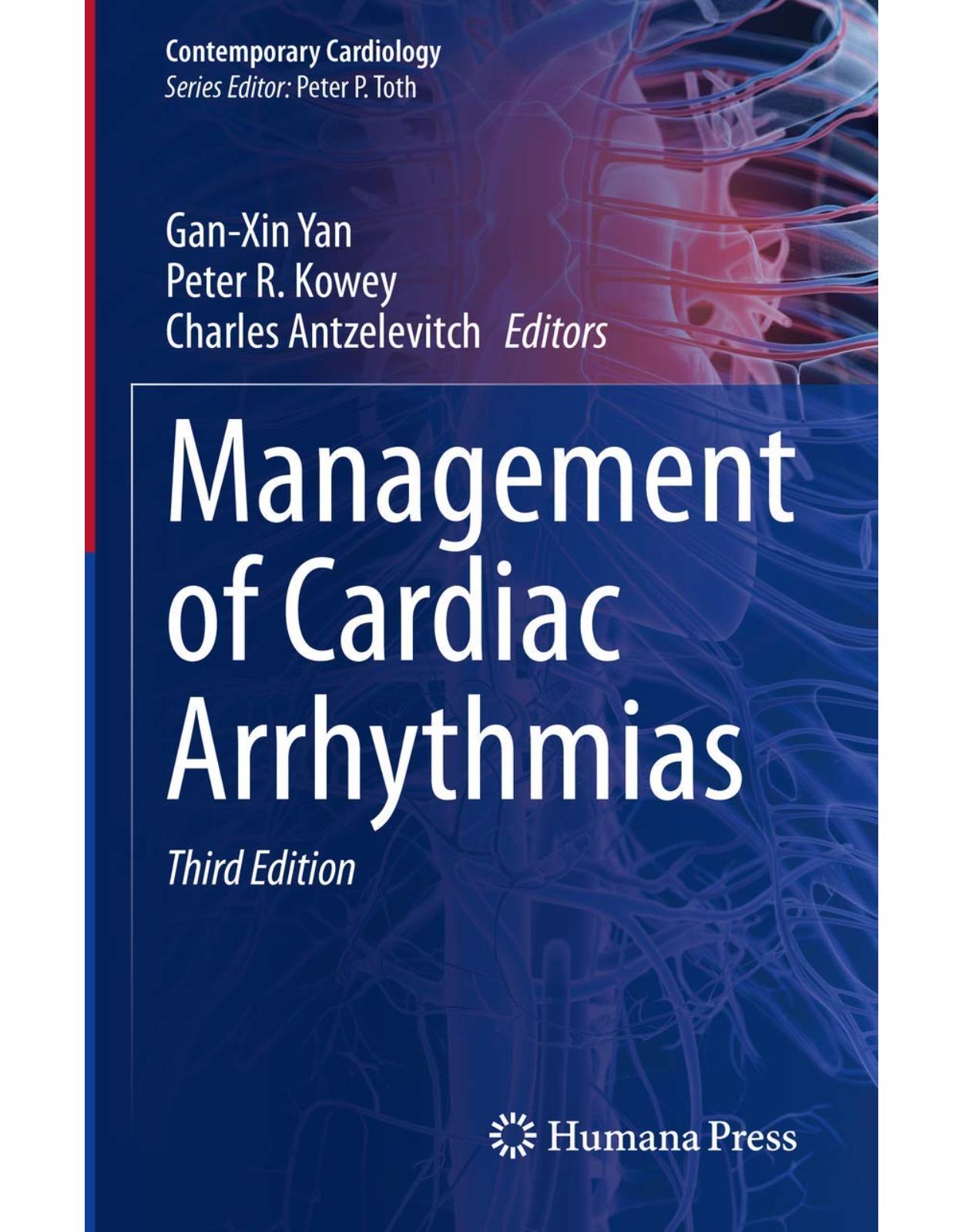 Management of Cardiac Arrhythmias 