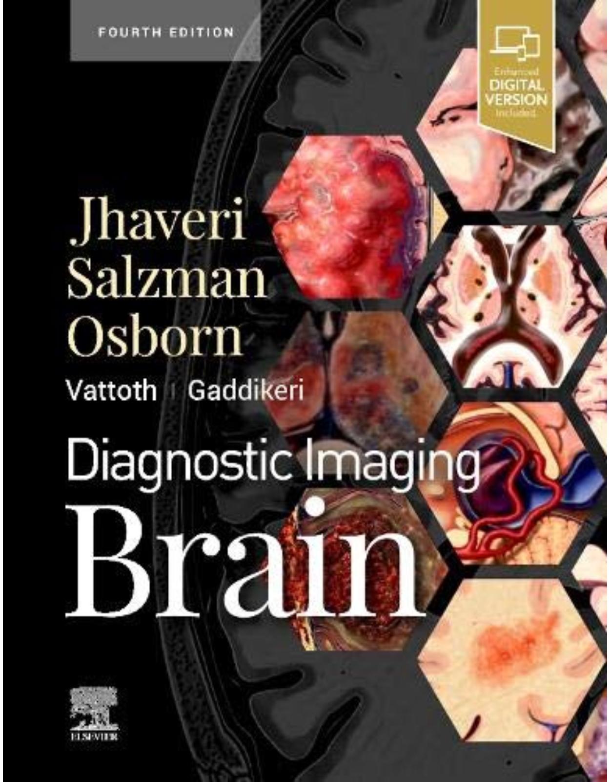 Diagnostic Imaging: Brain