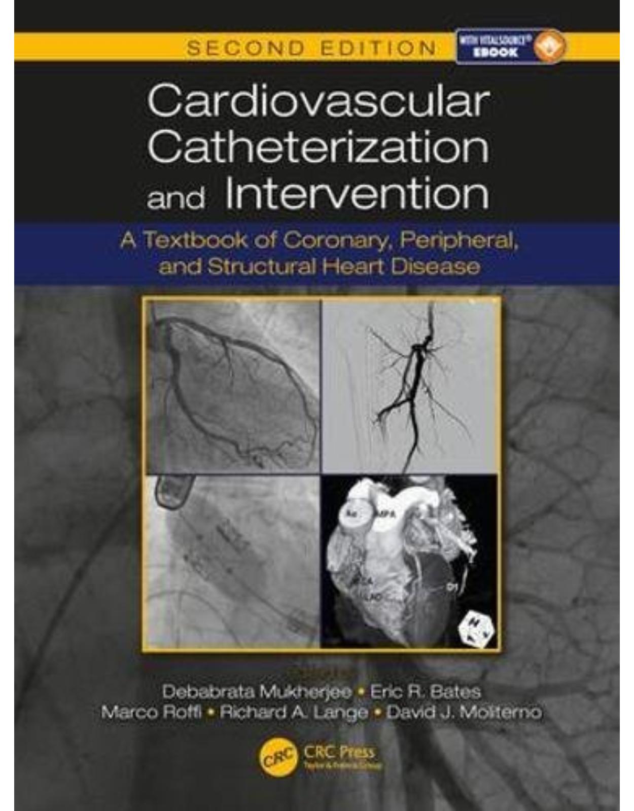 Cardiovascular Catheterization and Intervention: A Textbook, Second Edition