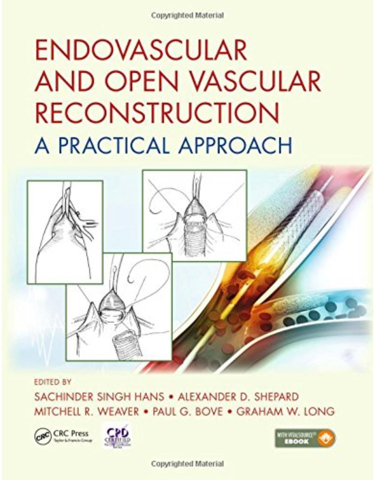  Endovascular and Open Vascular Reconstruction: A Practical Approach