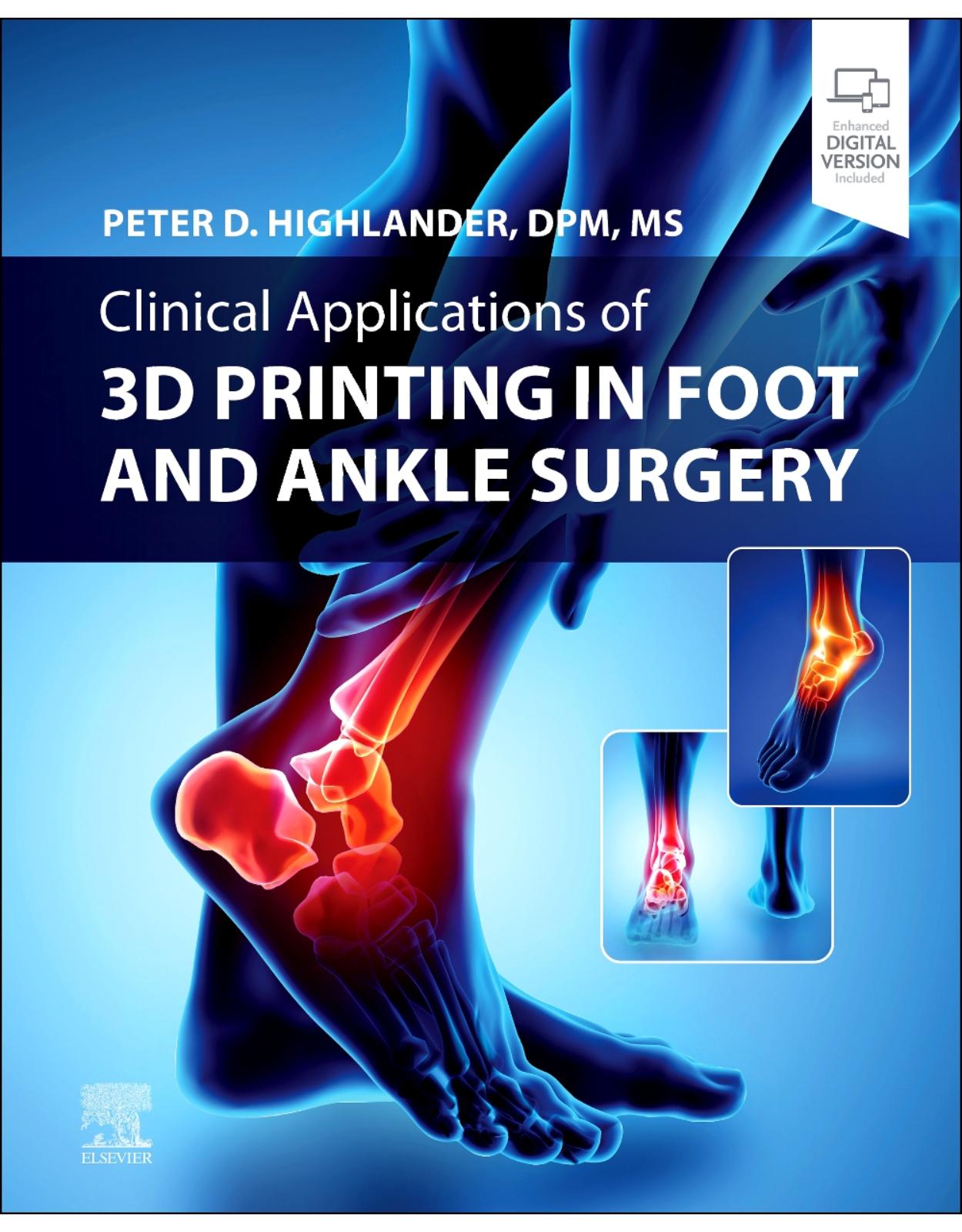 Clinical Applications of 3D Printing in Foot and Ankle Surgery