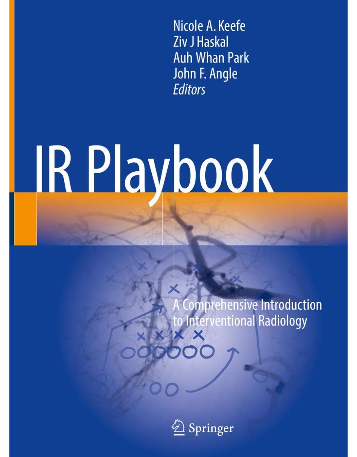 IR Playbook