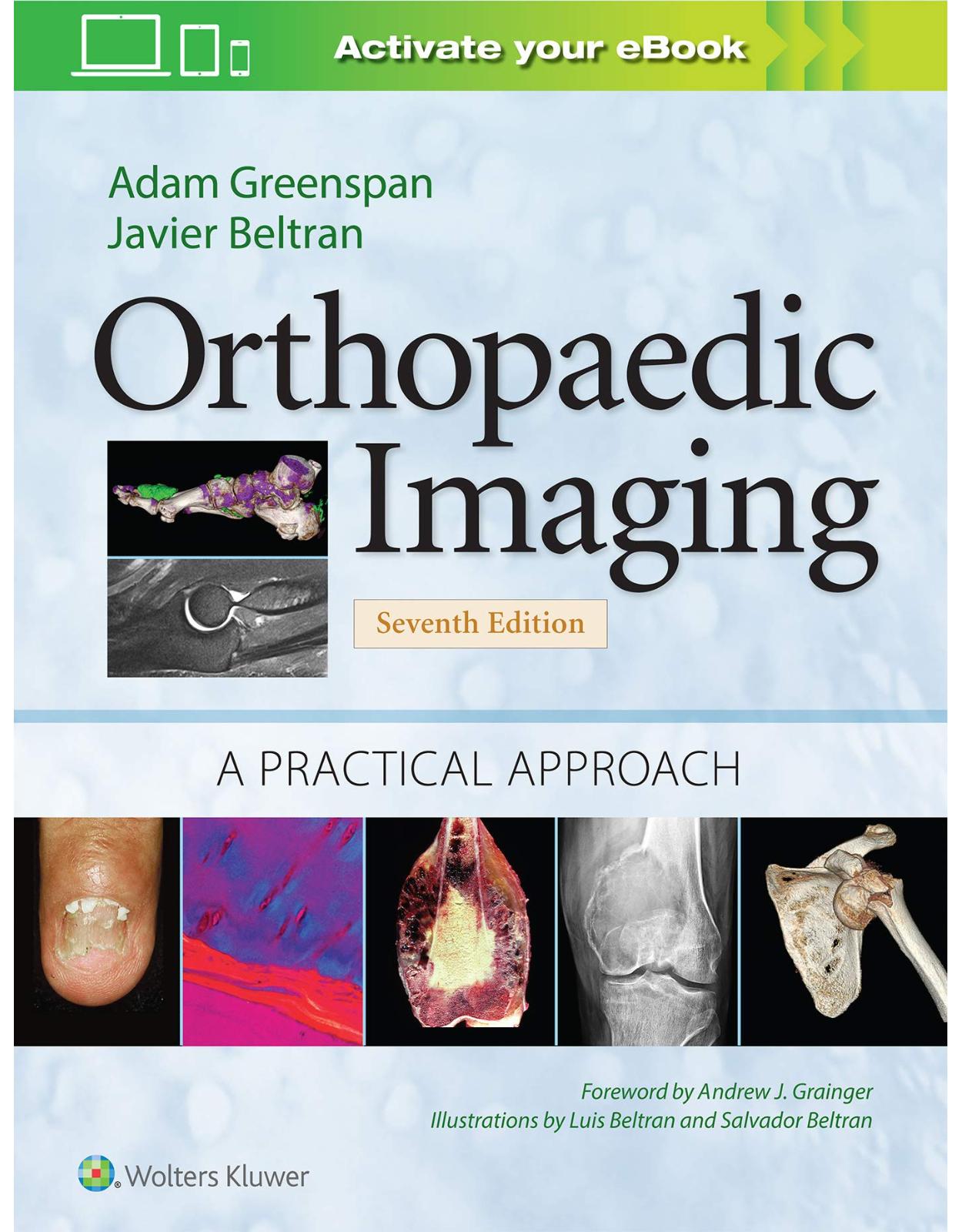 Orthopaedic Imaging: A Practical Approach (Orthopedic Imaging a Practical Approach)