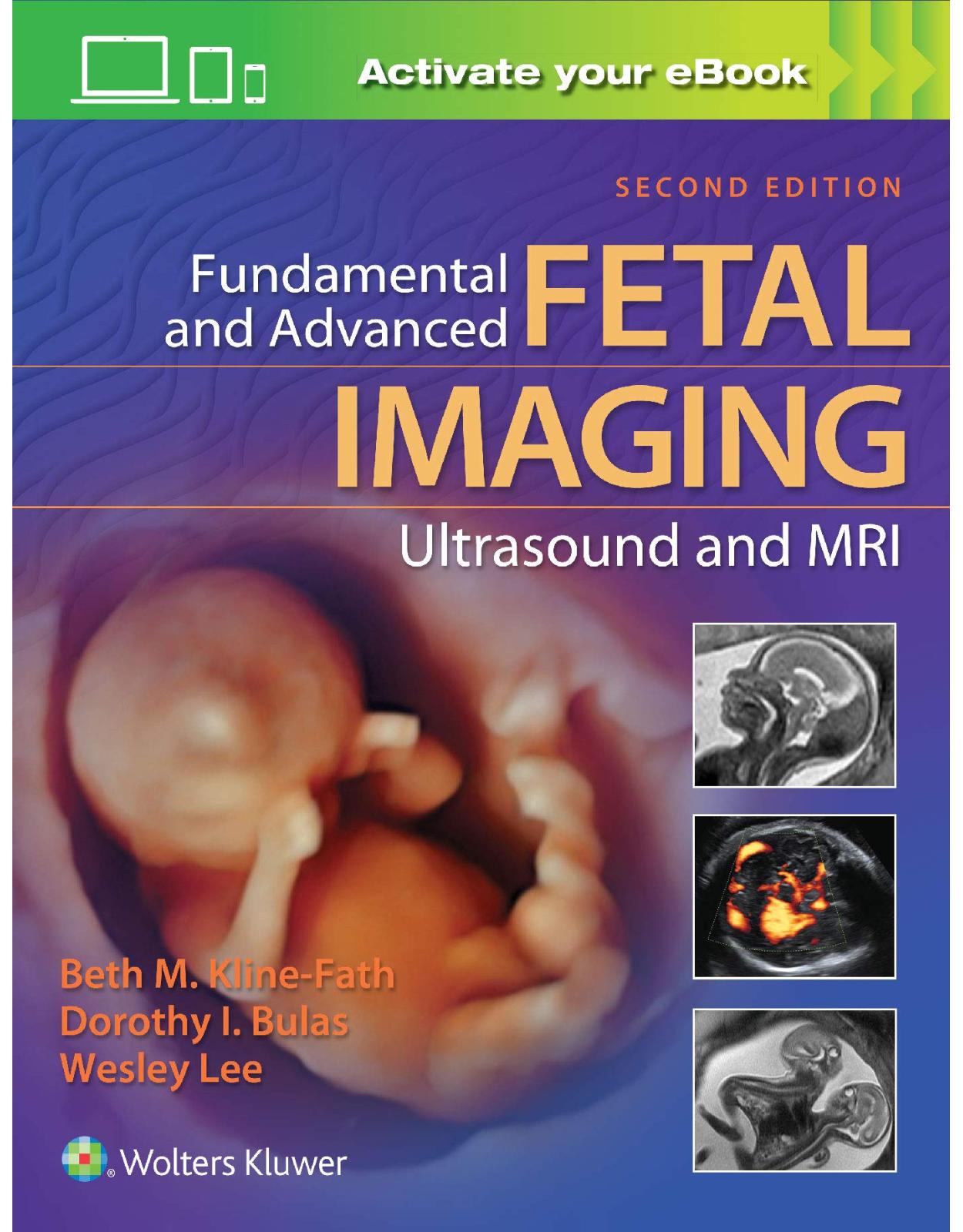 Fundamental and Advanced Fetal Imaging Ultrasound and MRI