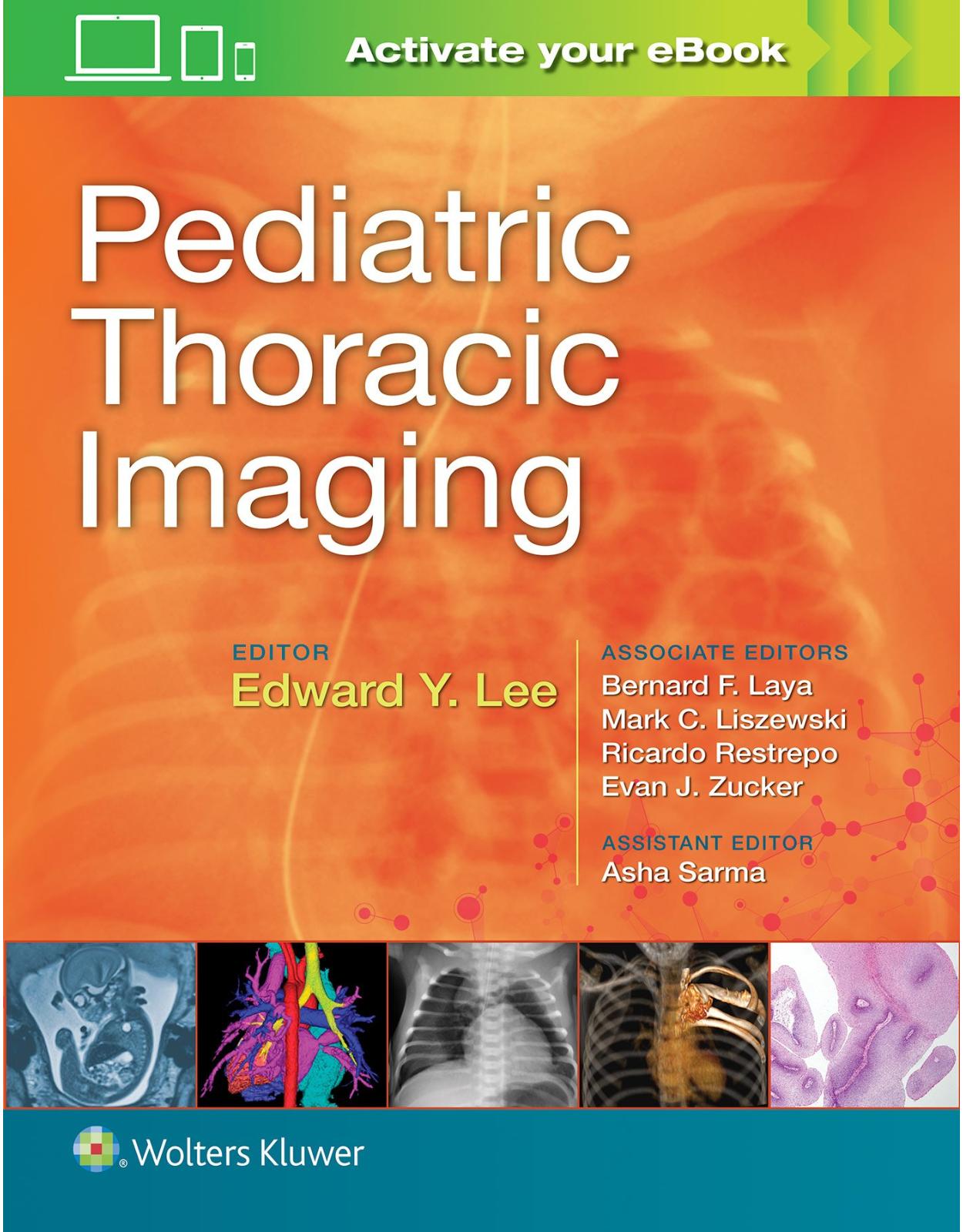 Pediatric Thoracic Imaging