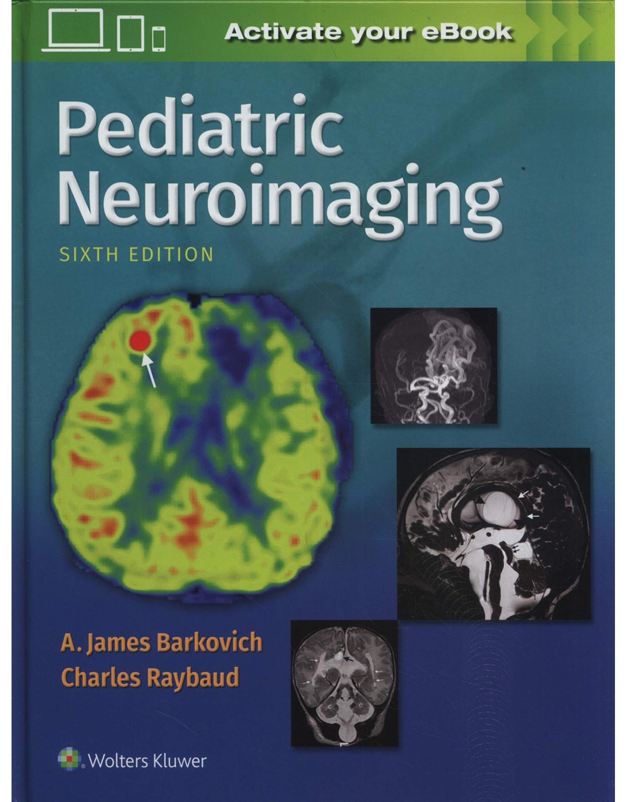 Pediatric Neuroimaging