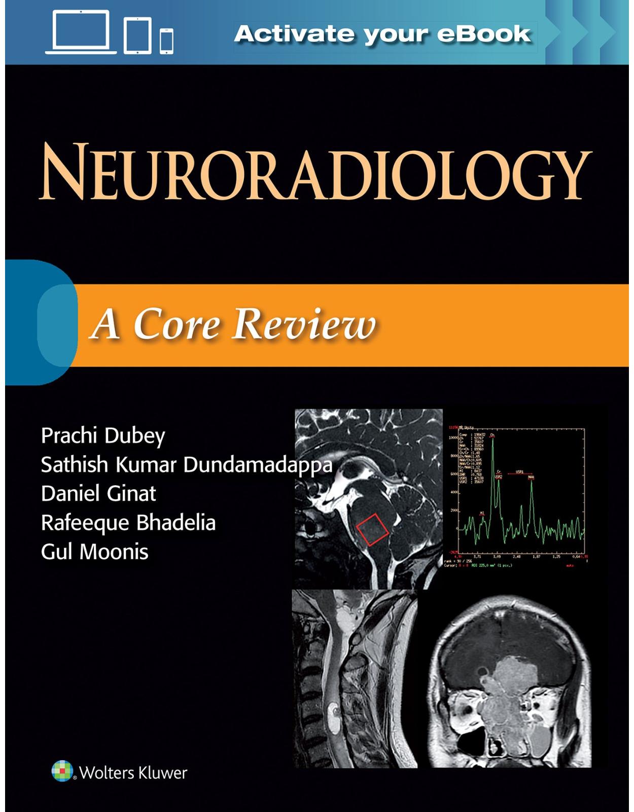 Neuroradiology: A Core Review