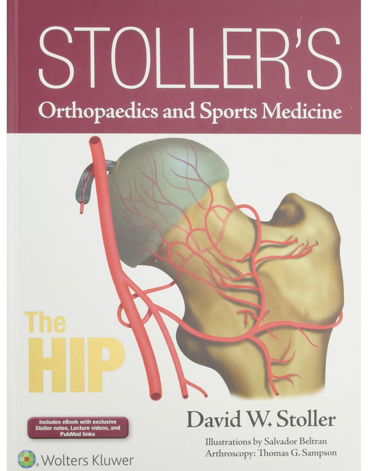 Stoller’s Orthopaedics and Sports Medicine: The Hip (Stollers Orthopaedics & Sports)