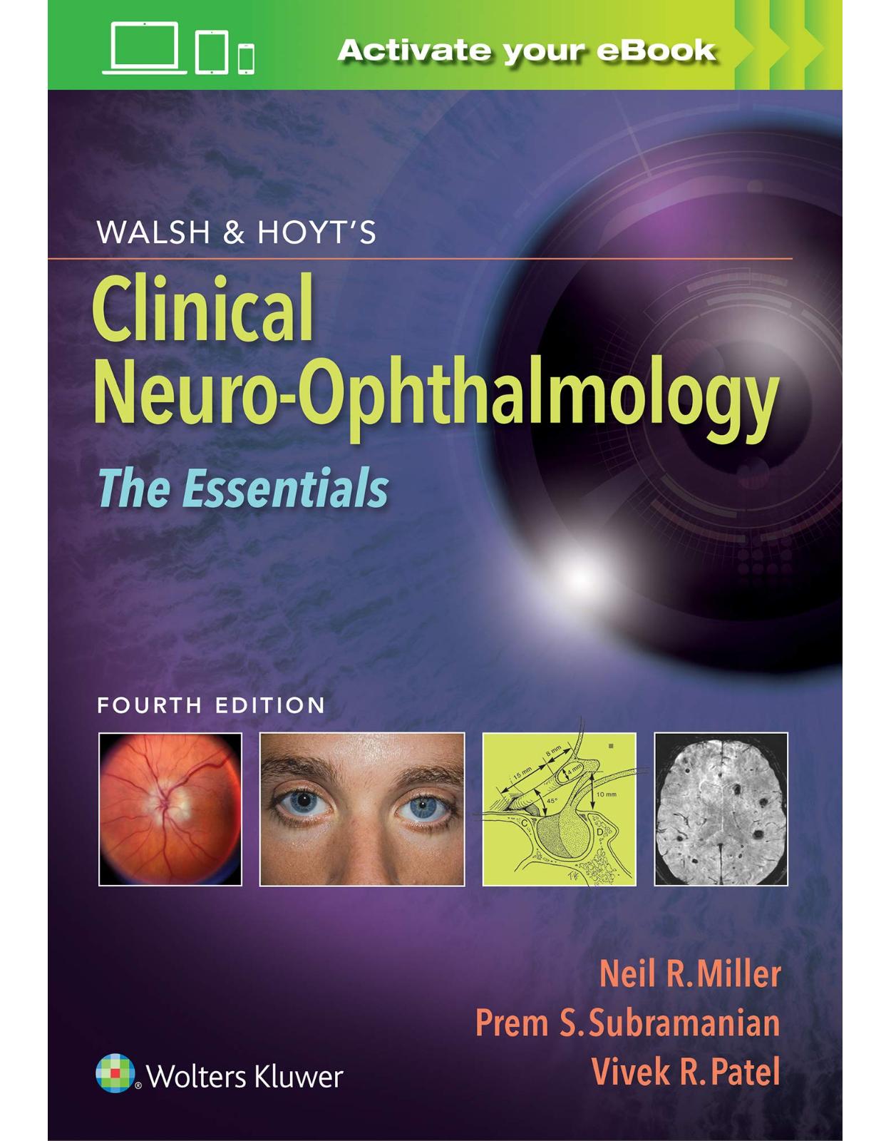 Walsh & Hoyt’s Clinical Neuro-Ophthalmology: The Essentials
